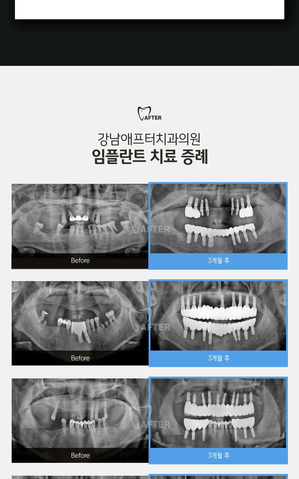 시술 상세 7