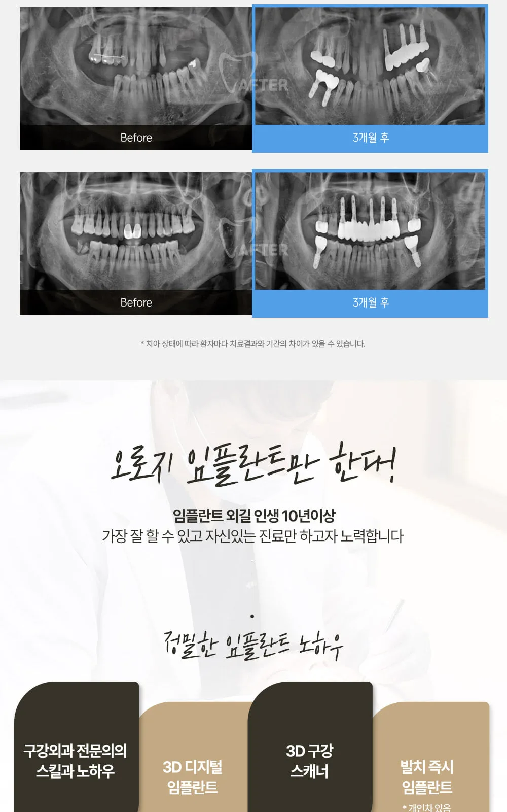시술 상세 9