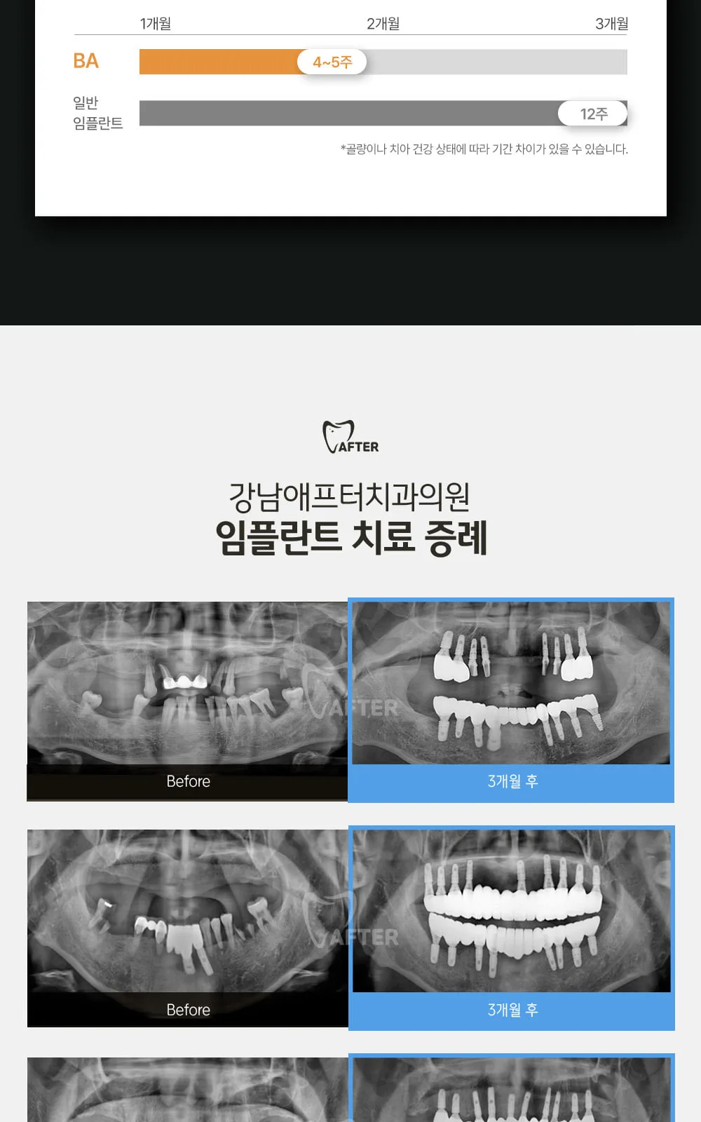 시술 상세 7