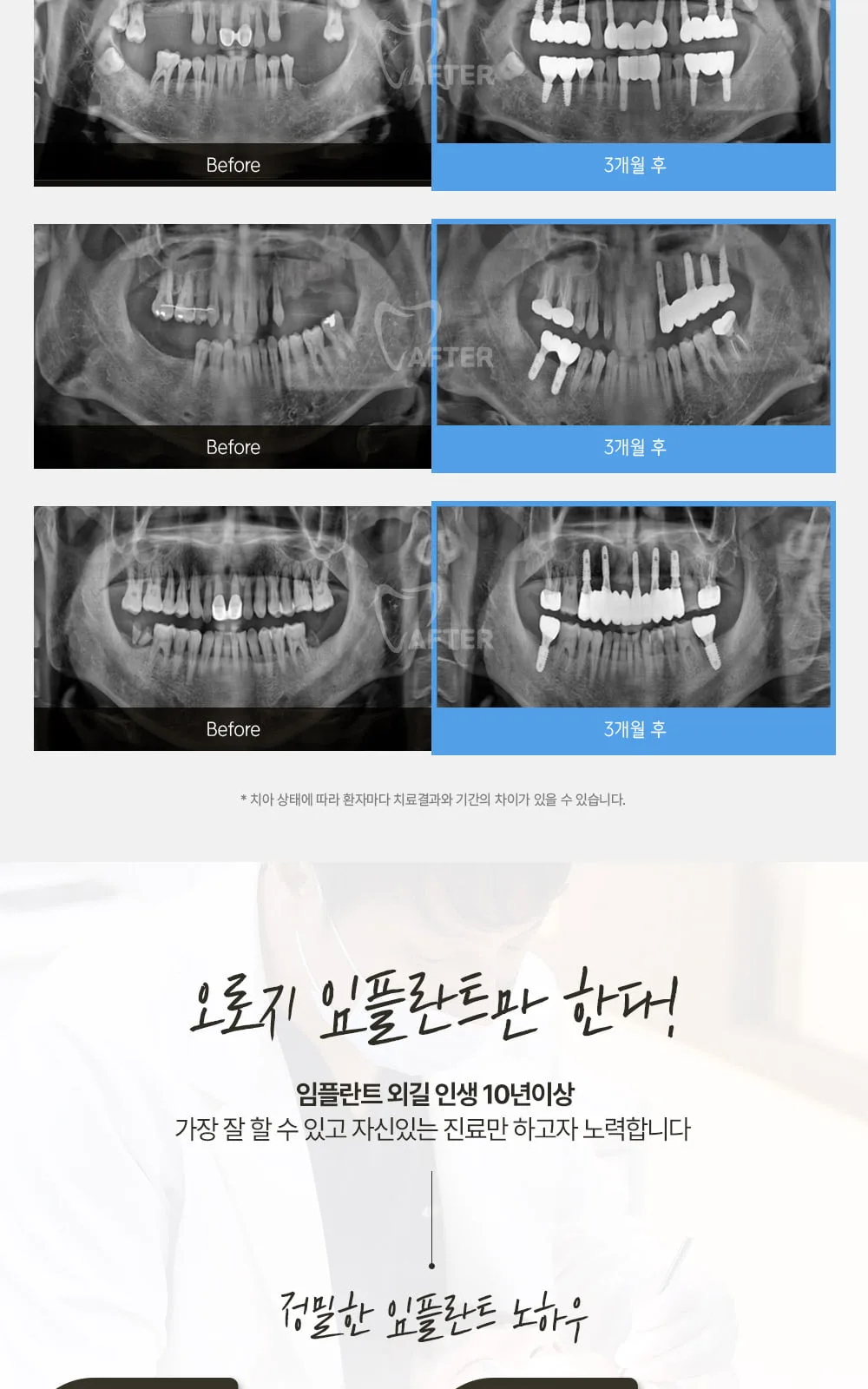 시술 상세 9