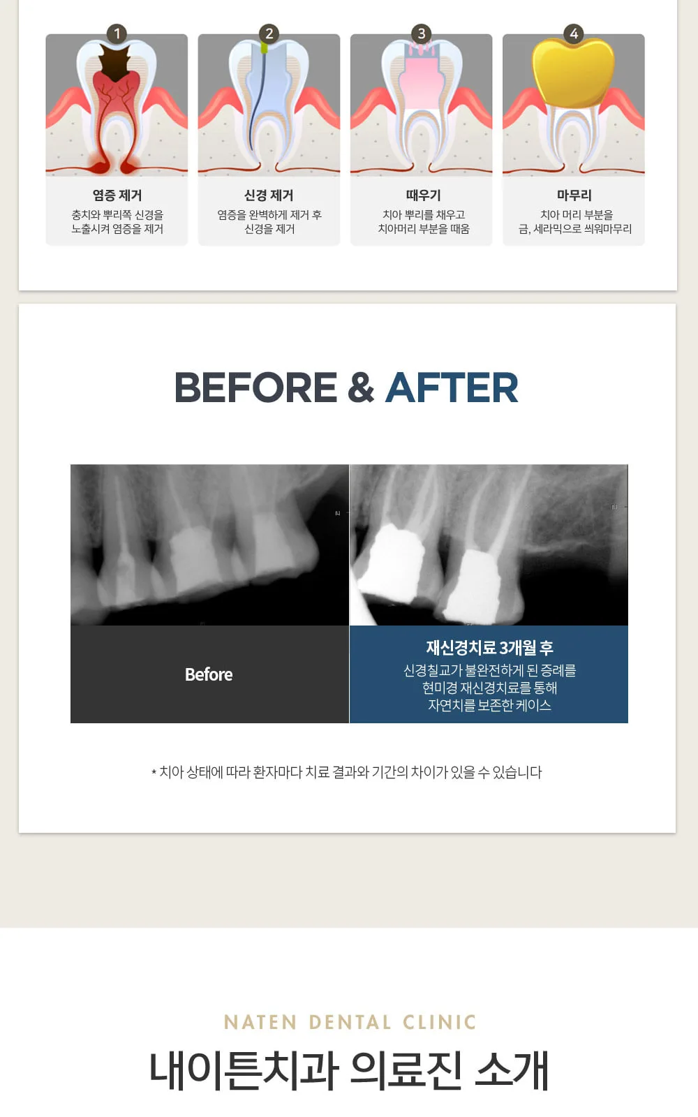 시술 상세 4