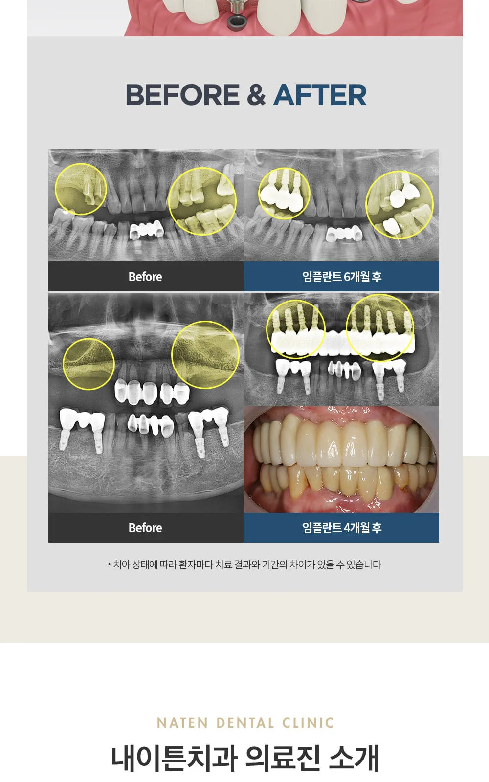 시술 상세 4