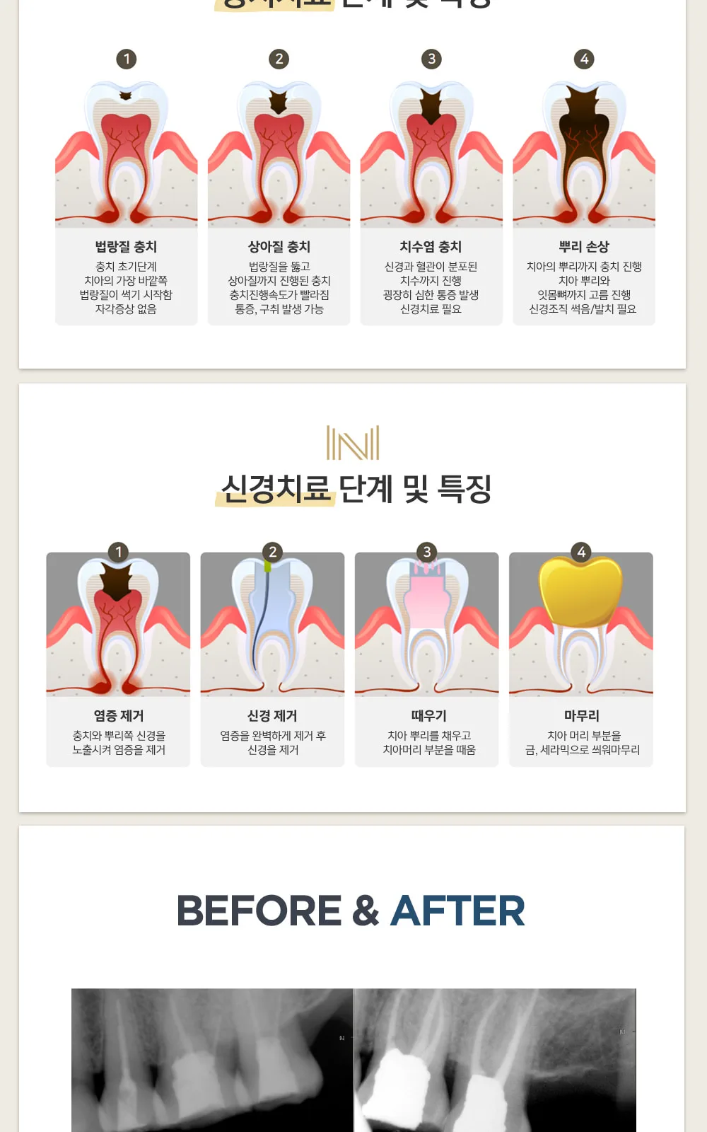 시술 상세 6