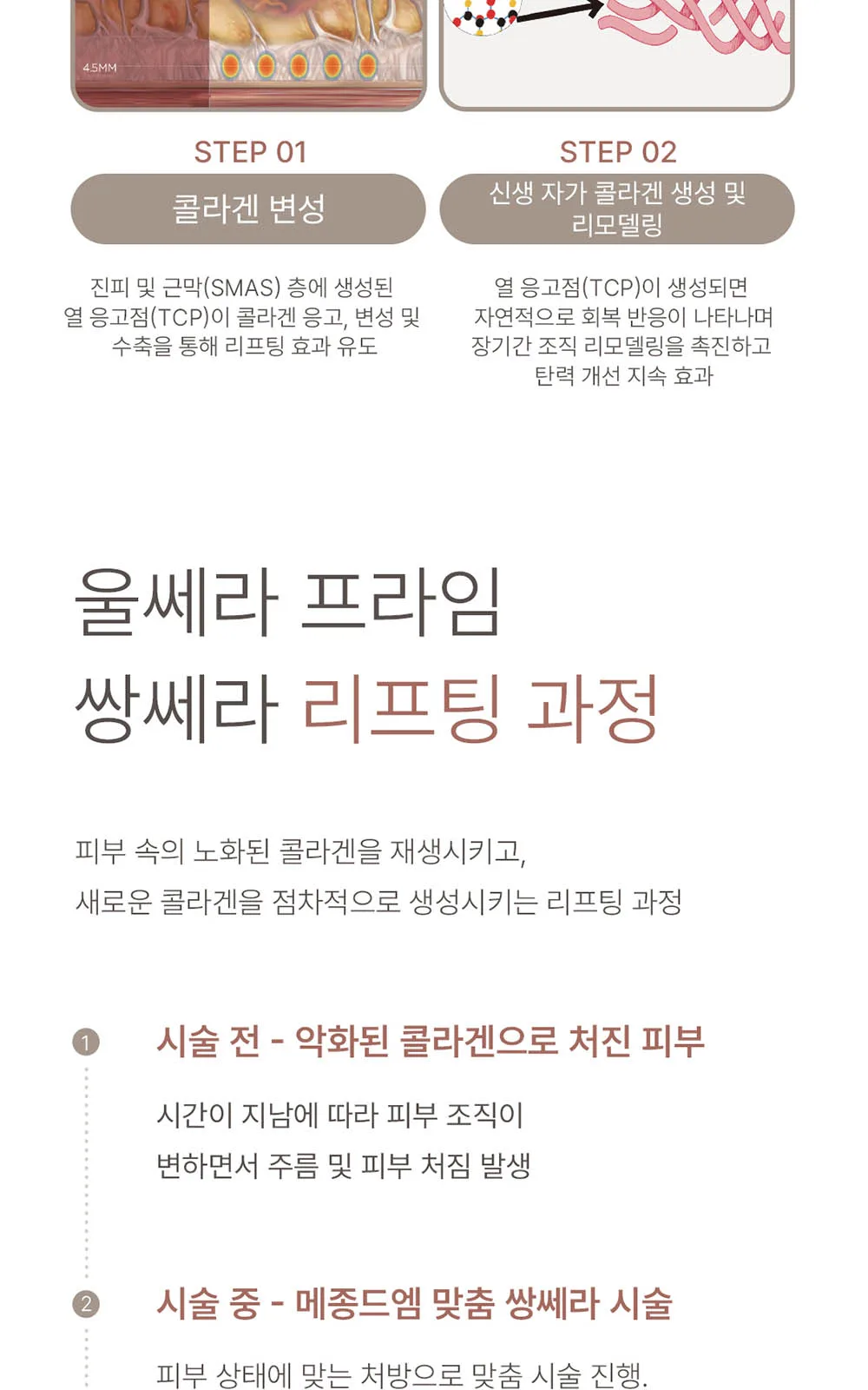 시술 상세 10