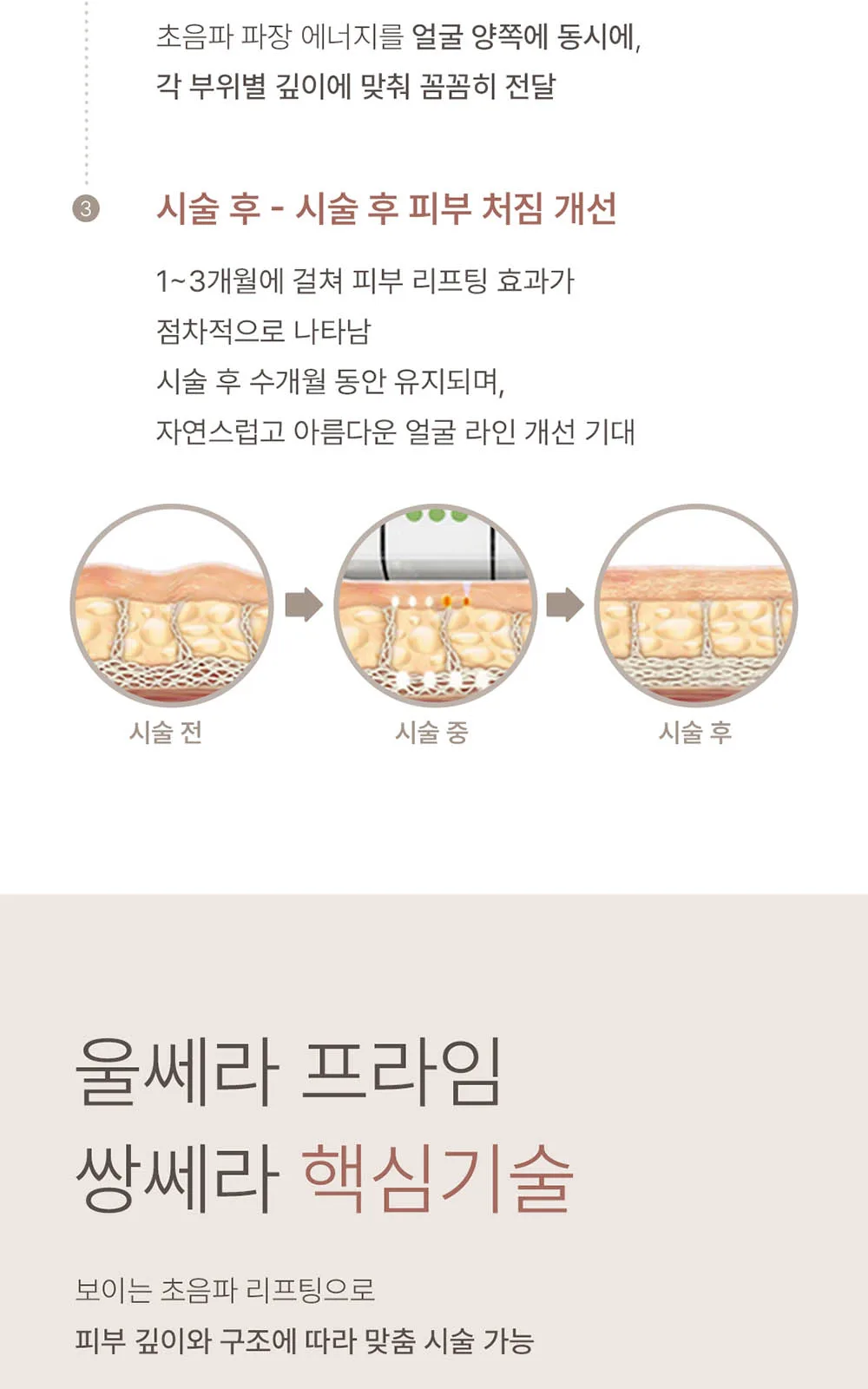 시술 상세 11