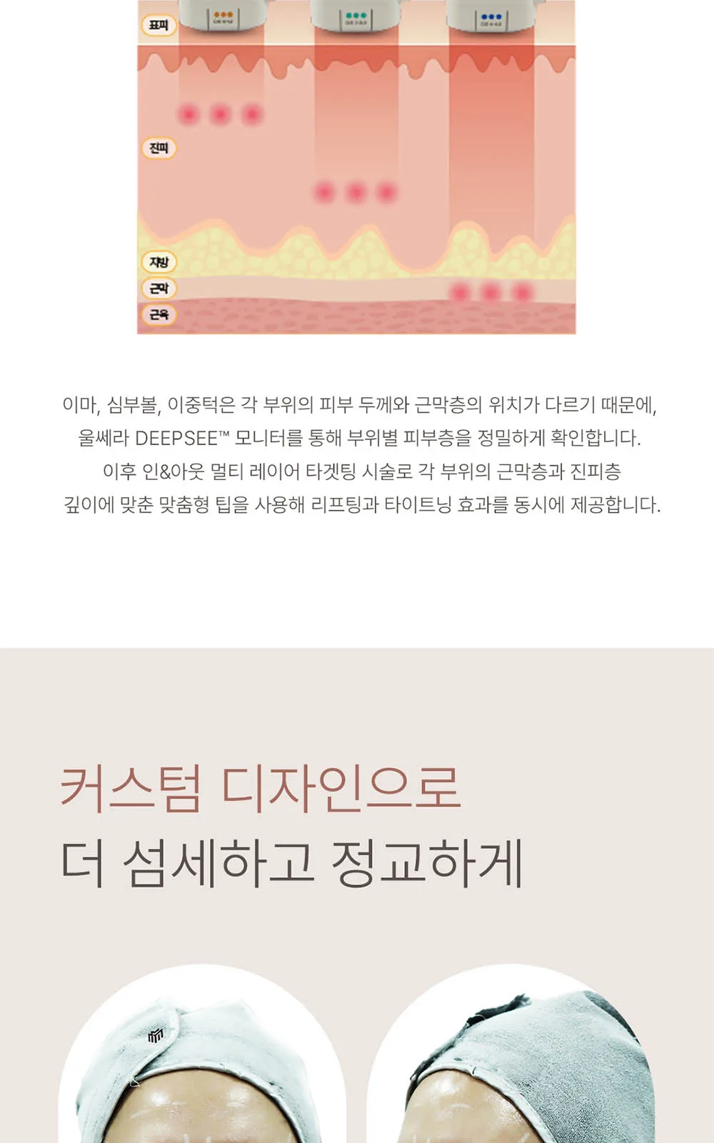 시술 상세 13