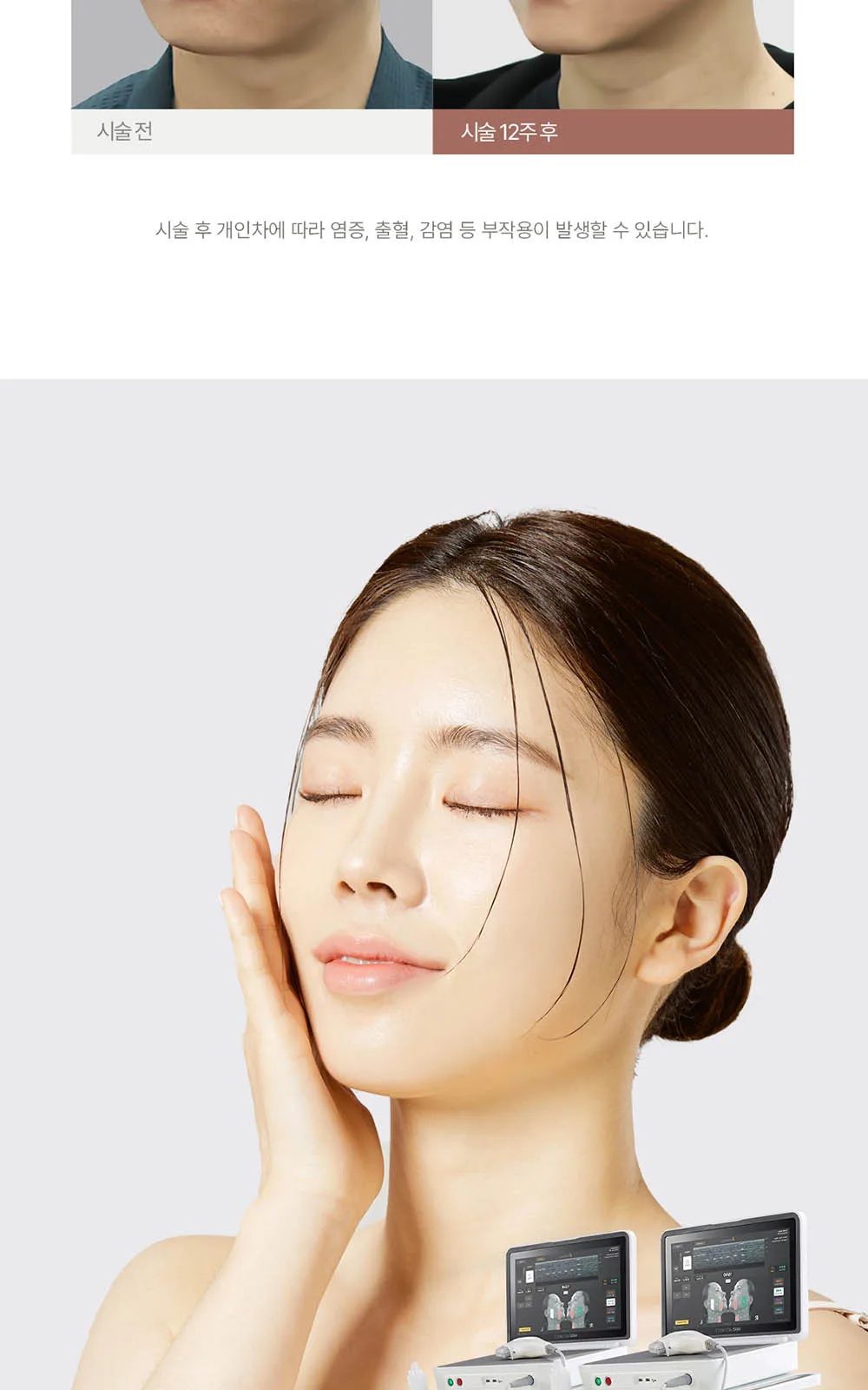 시술 상세 17
