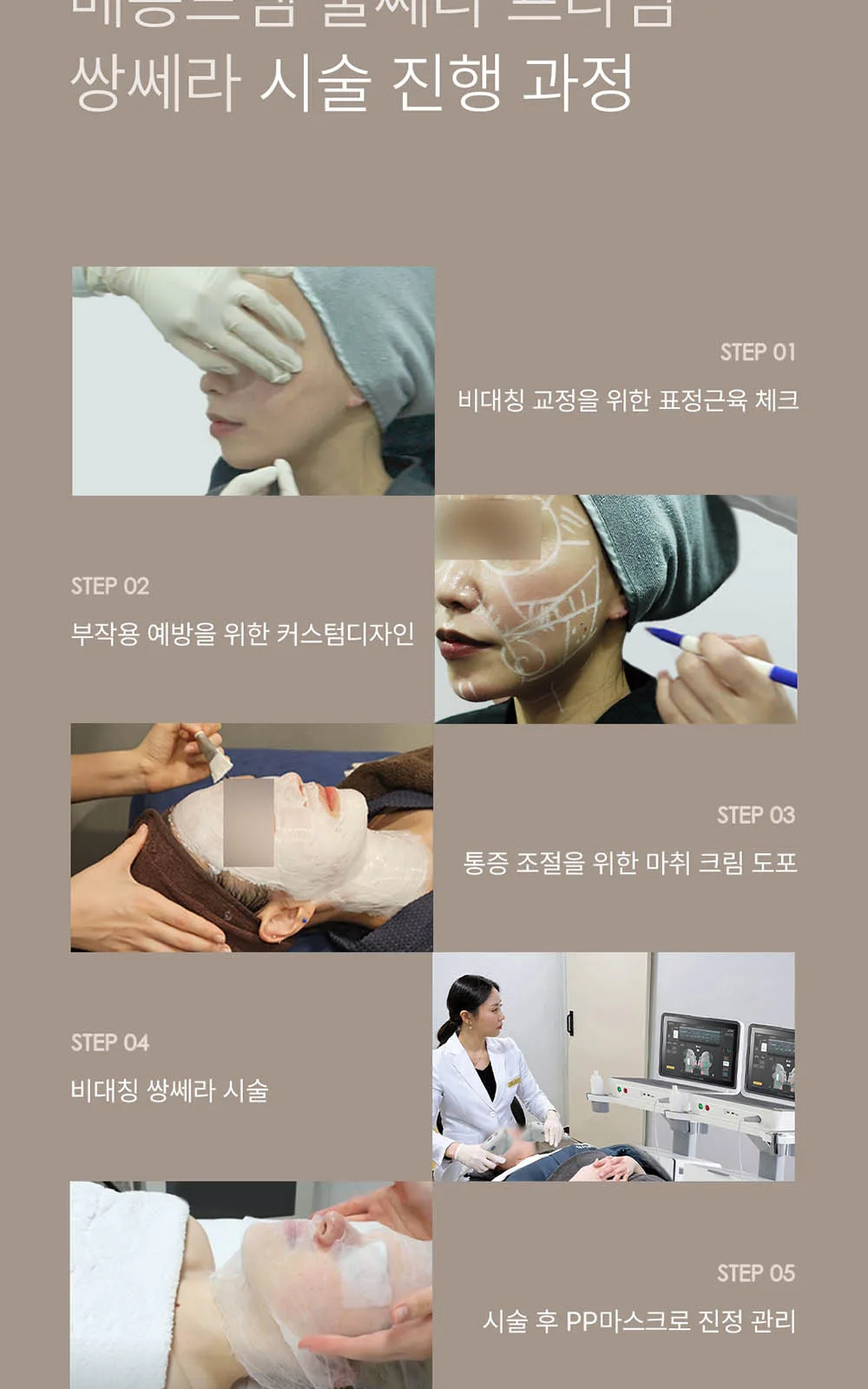 시술 상세 20