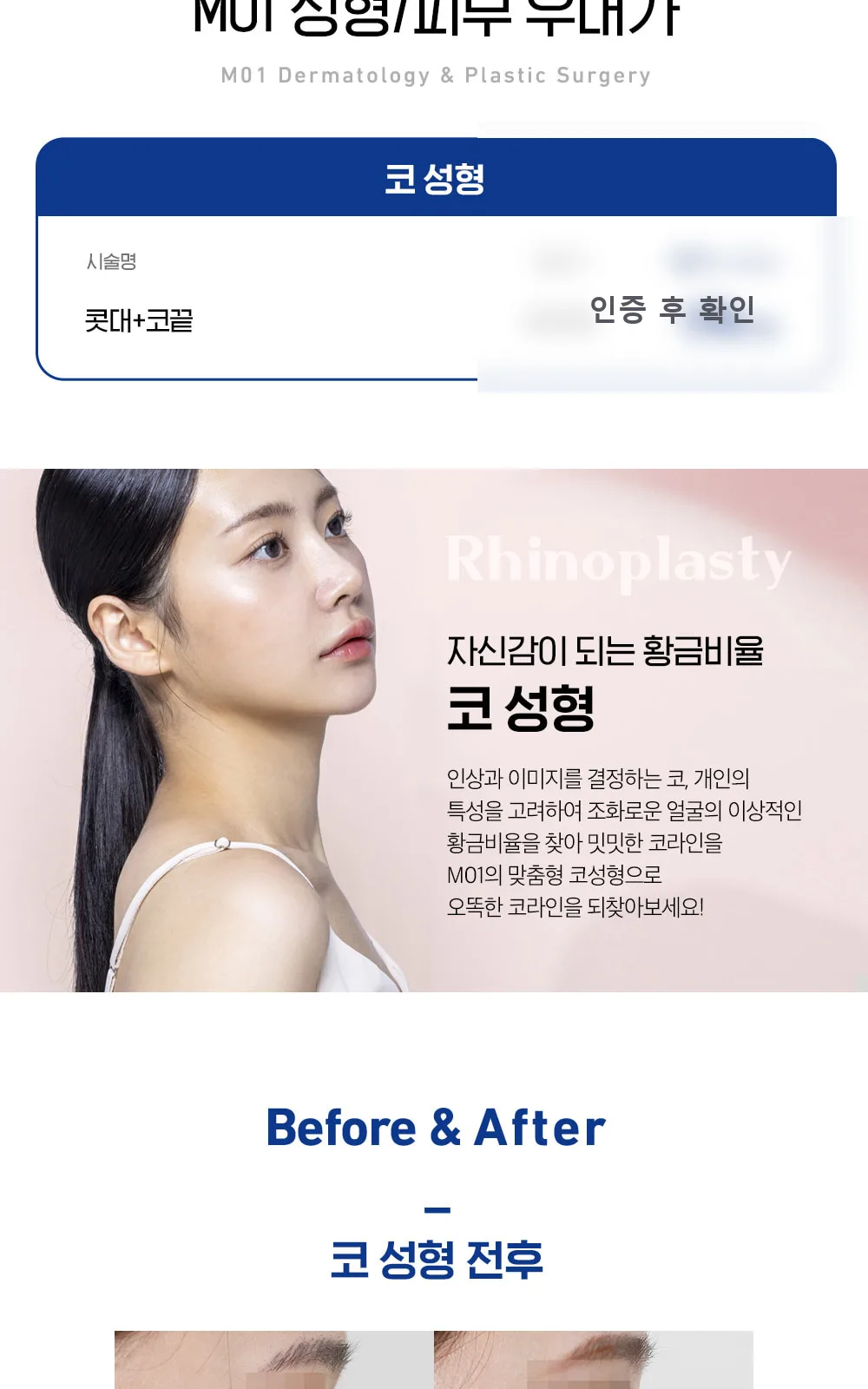 시술 상세 4