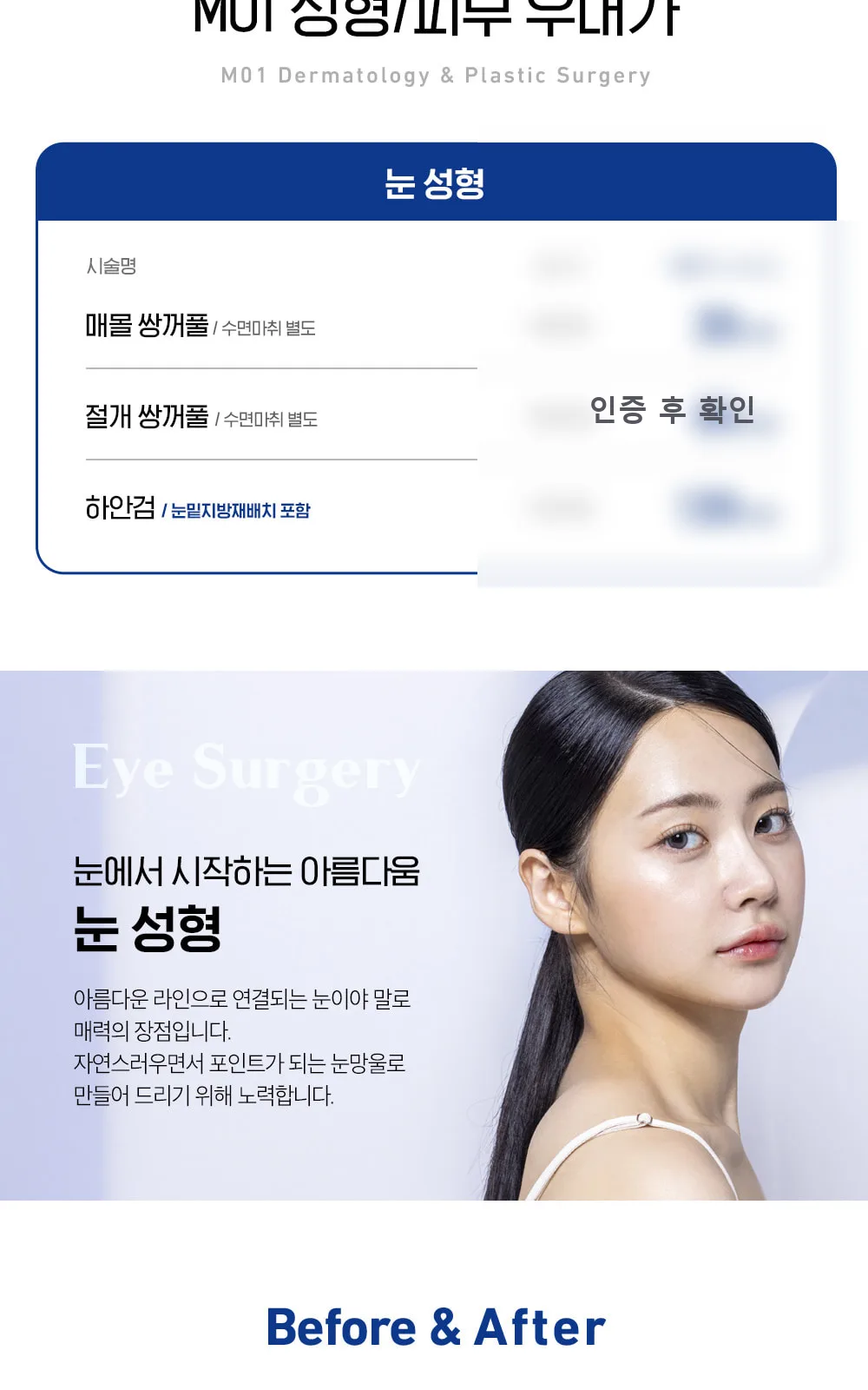 시술 상세 4