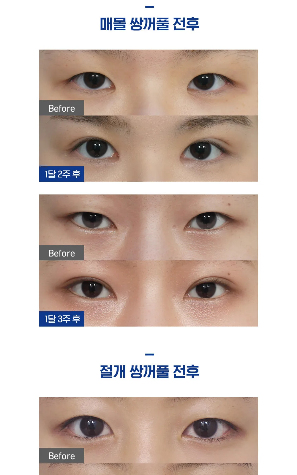 시술 상세 5