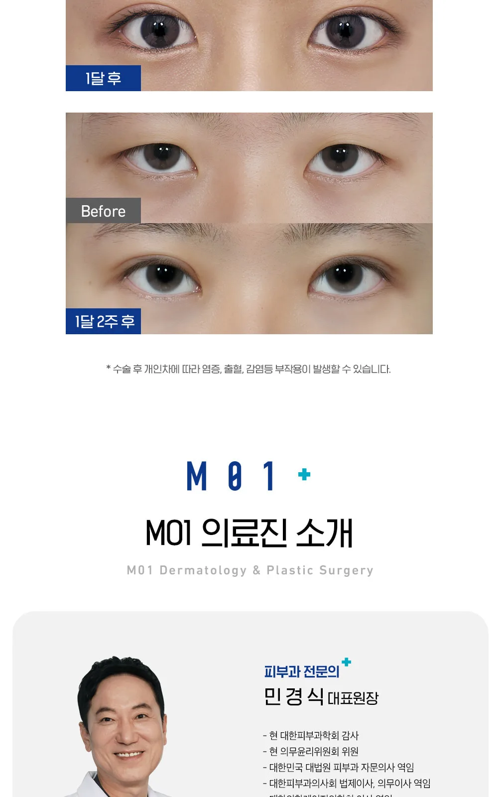 시술 상세 6