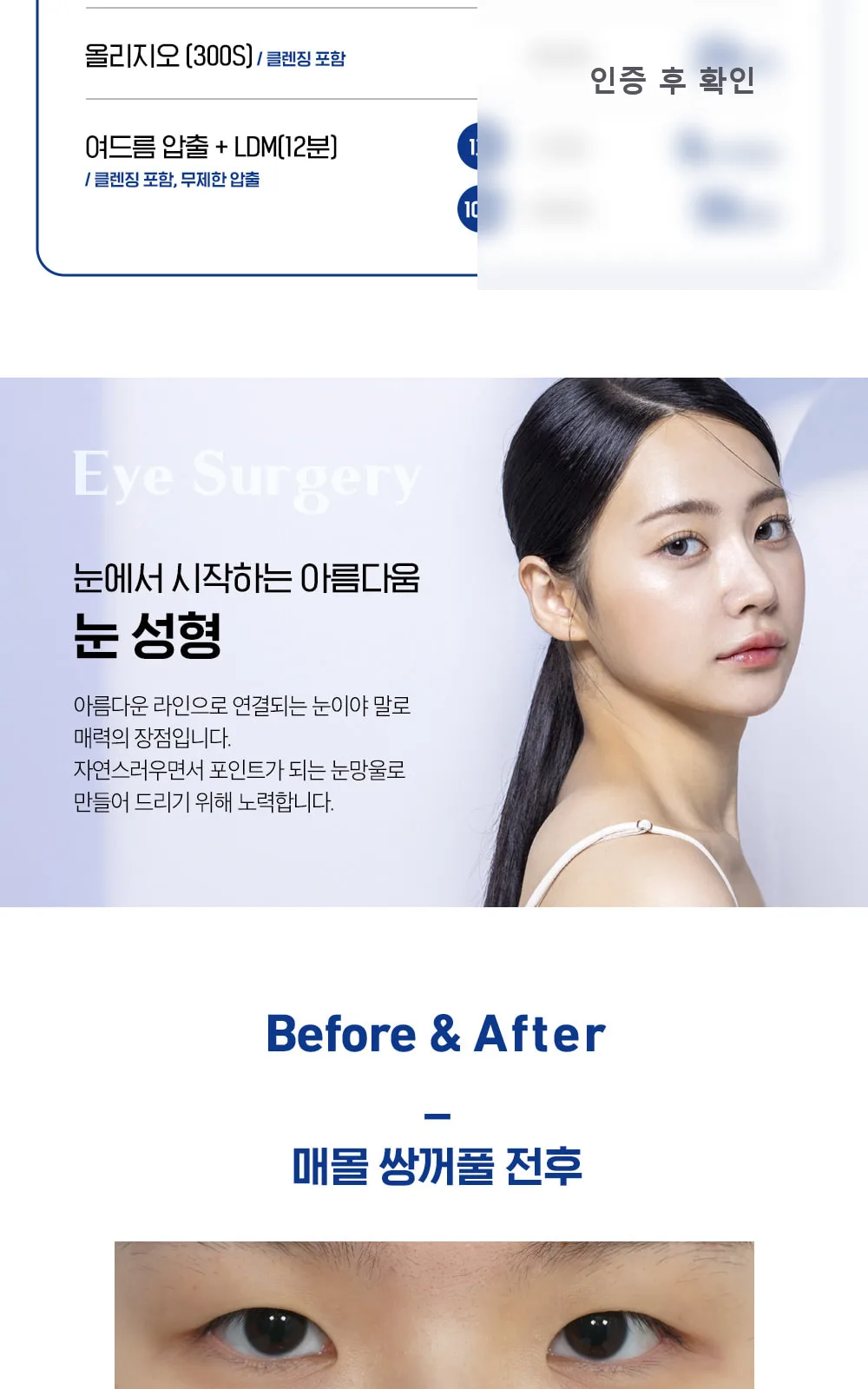 시술 상세 5