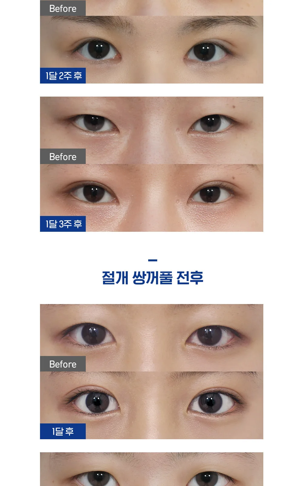 시술 상세 6