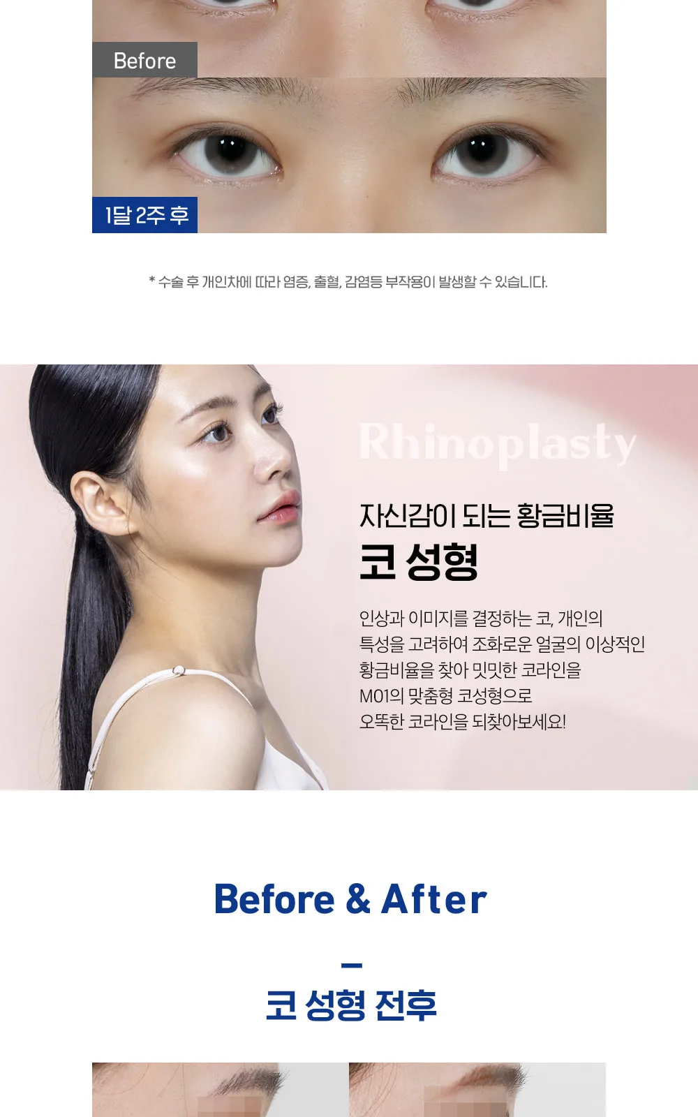 시술 상세 7