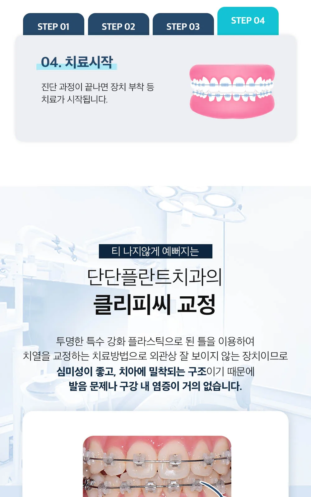 시술 상세 14