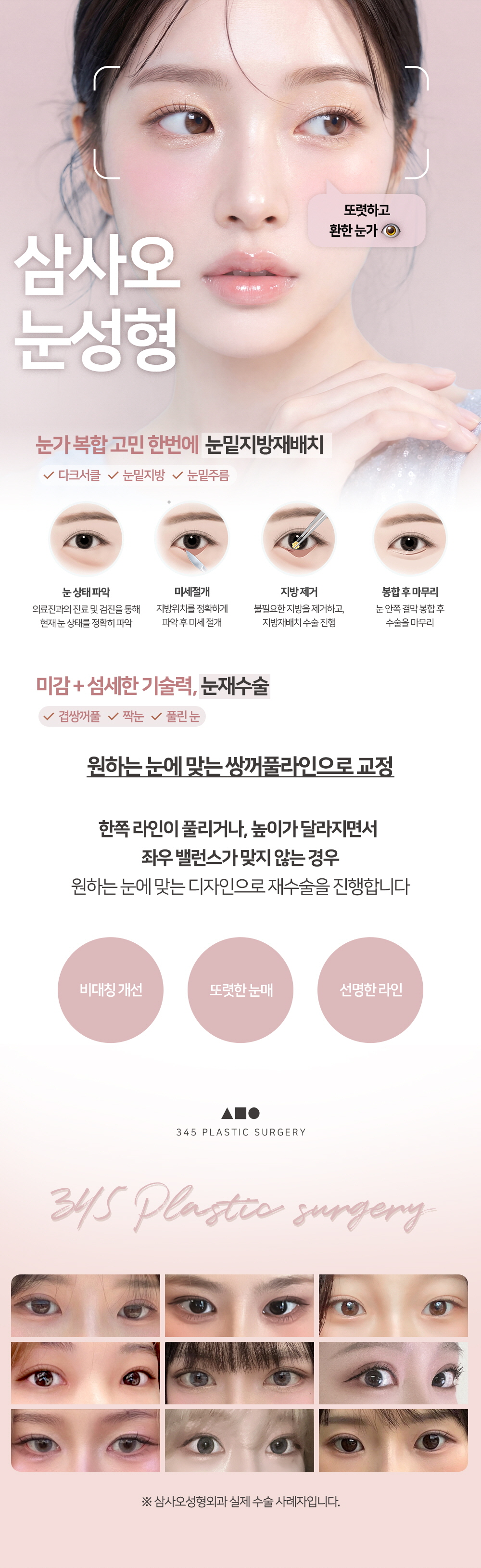 시술 상세 3