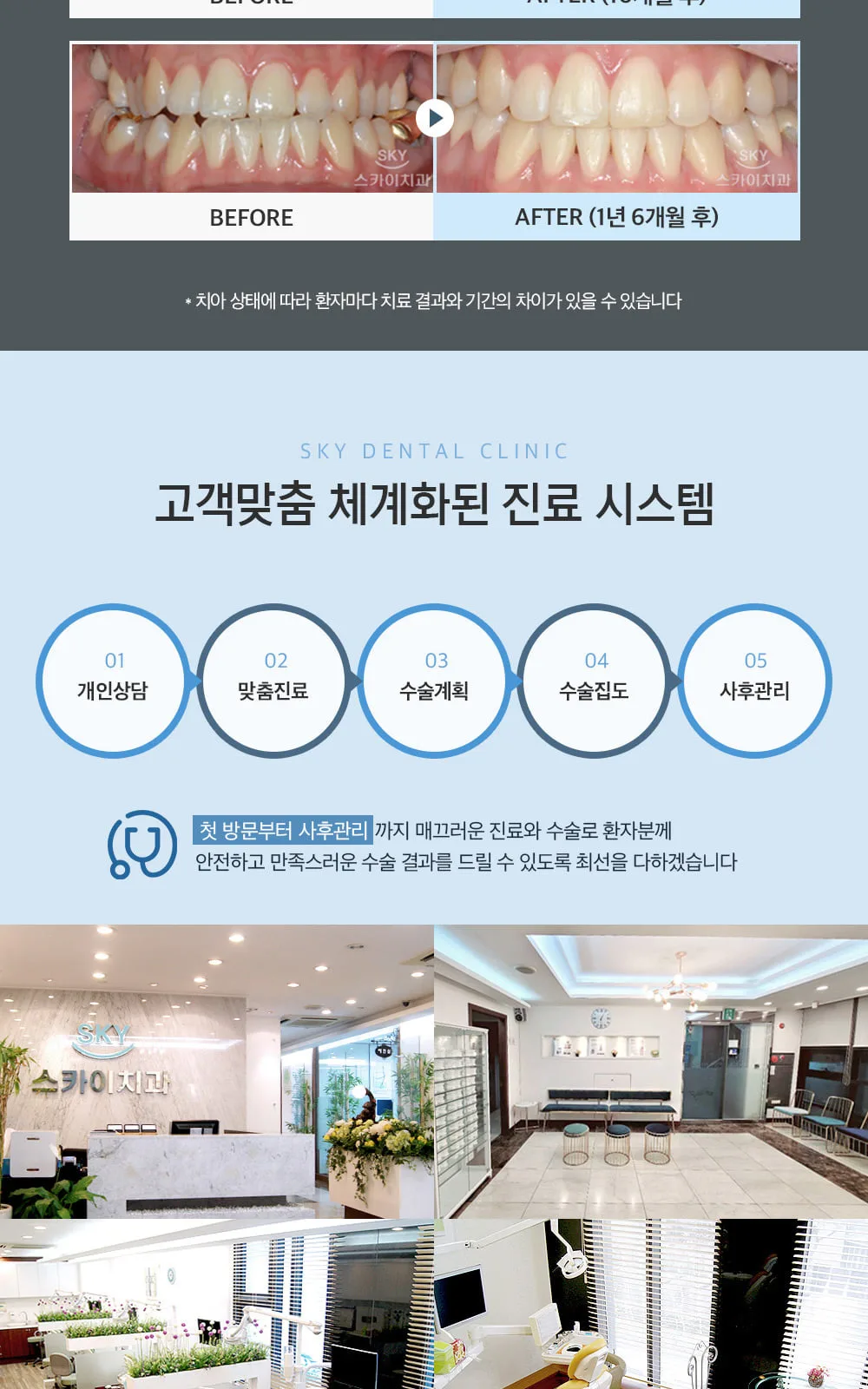 시술 상세 7