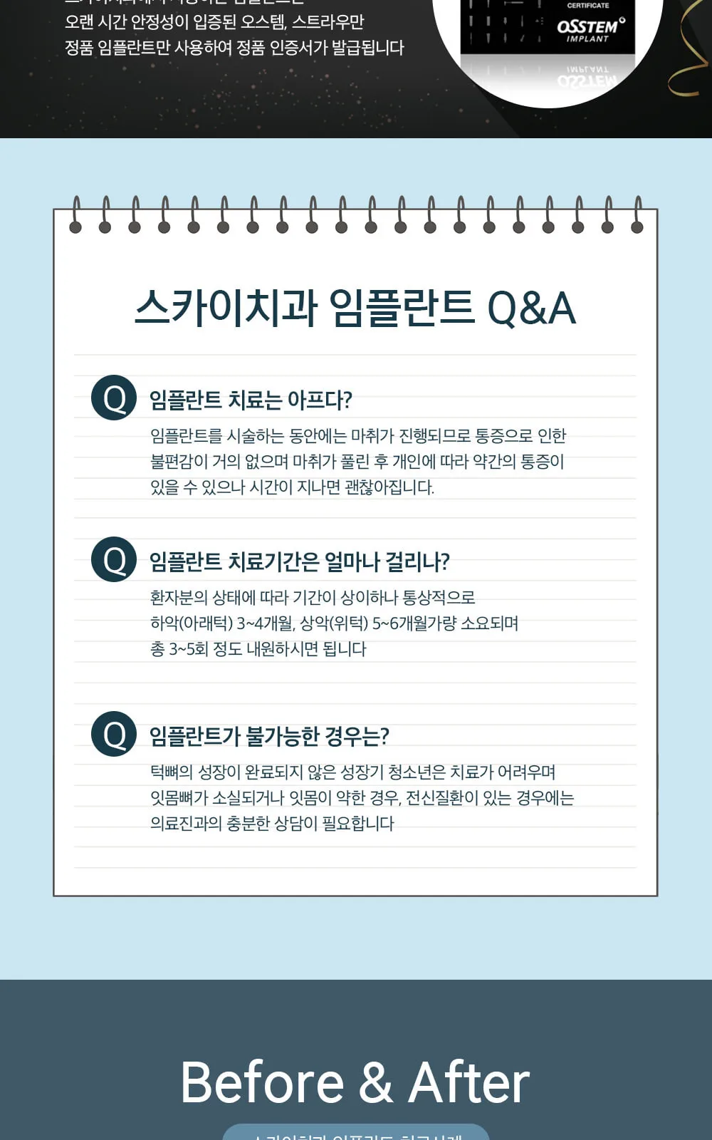 시술 상세 5