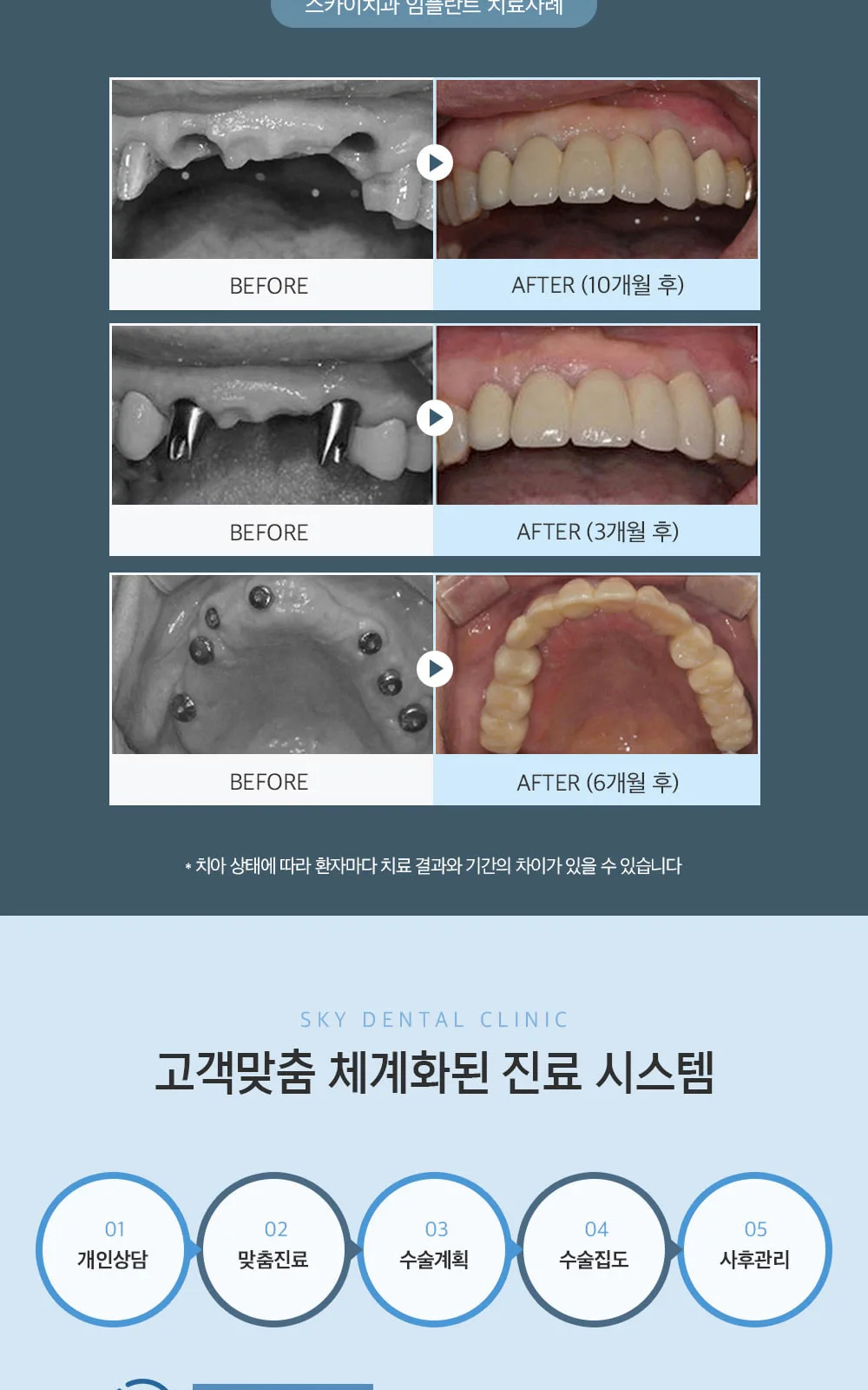 시술 상세 6