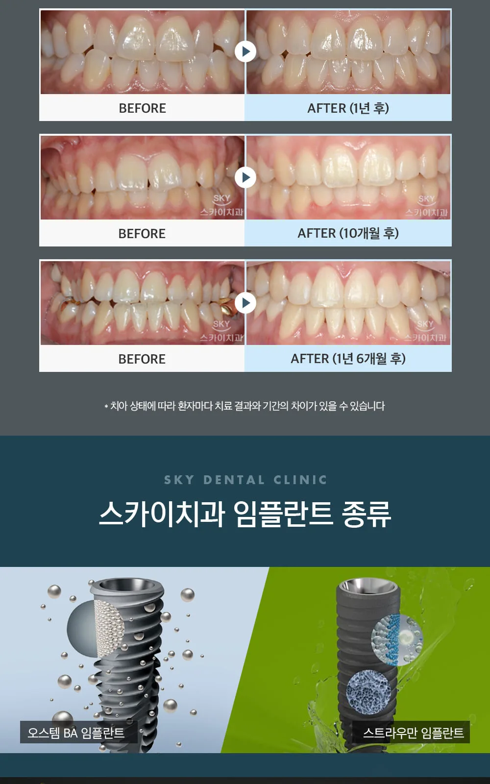 시술 상세 9