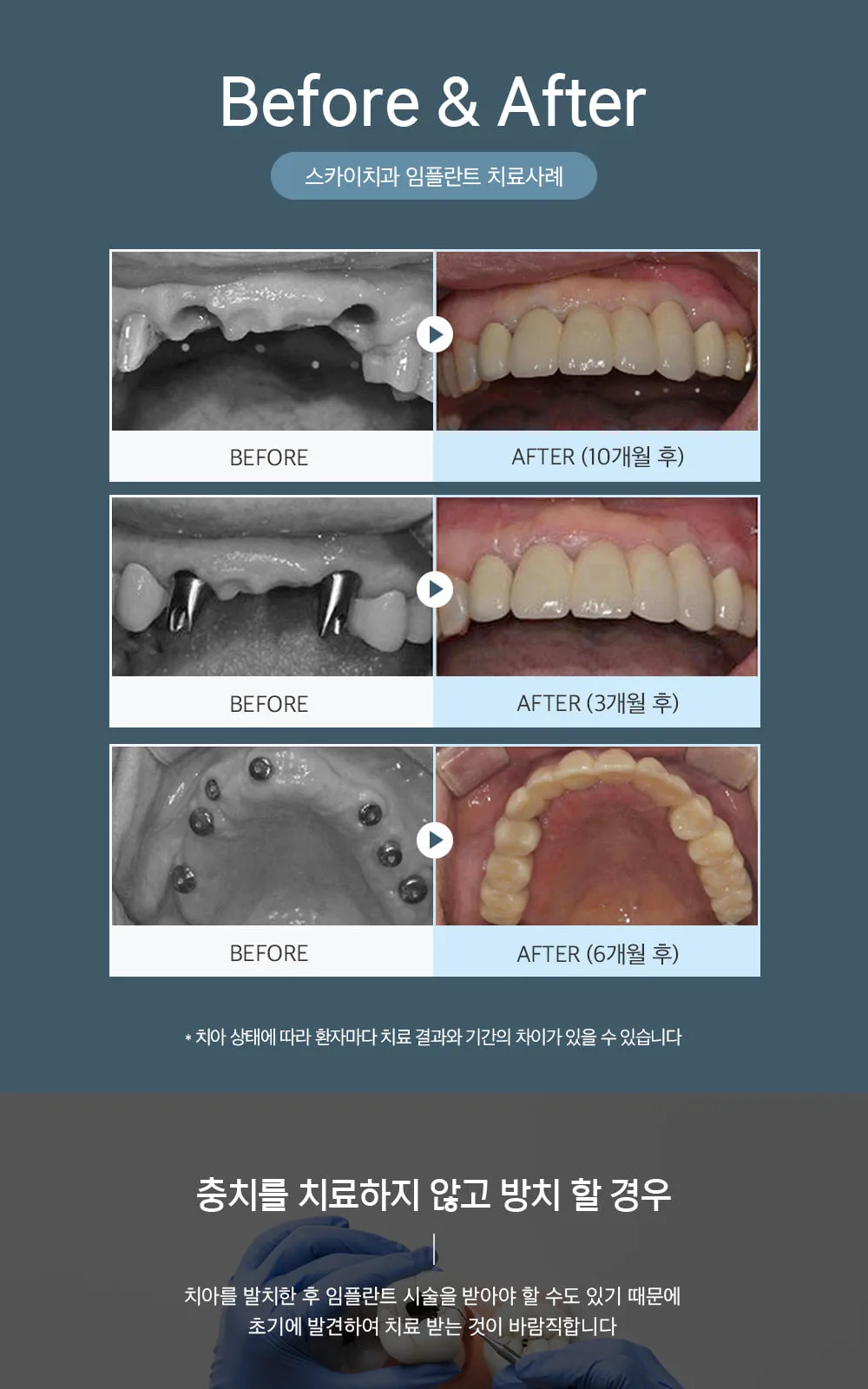 시술 상세 11