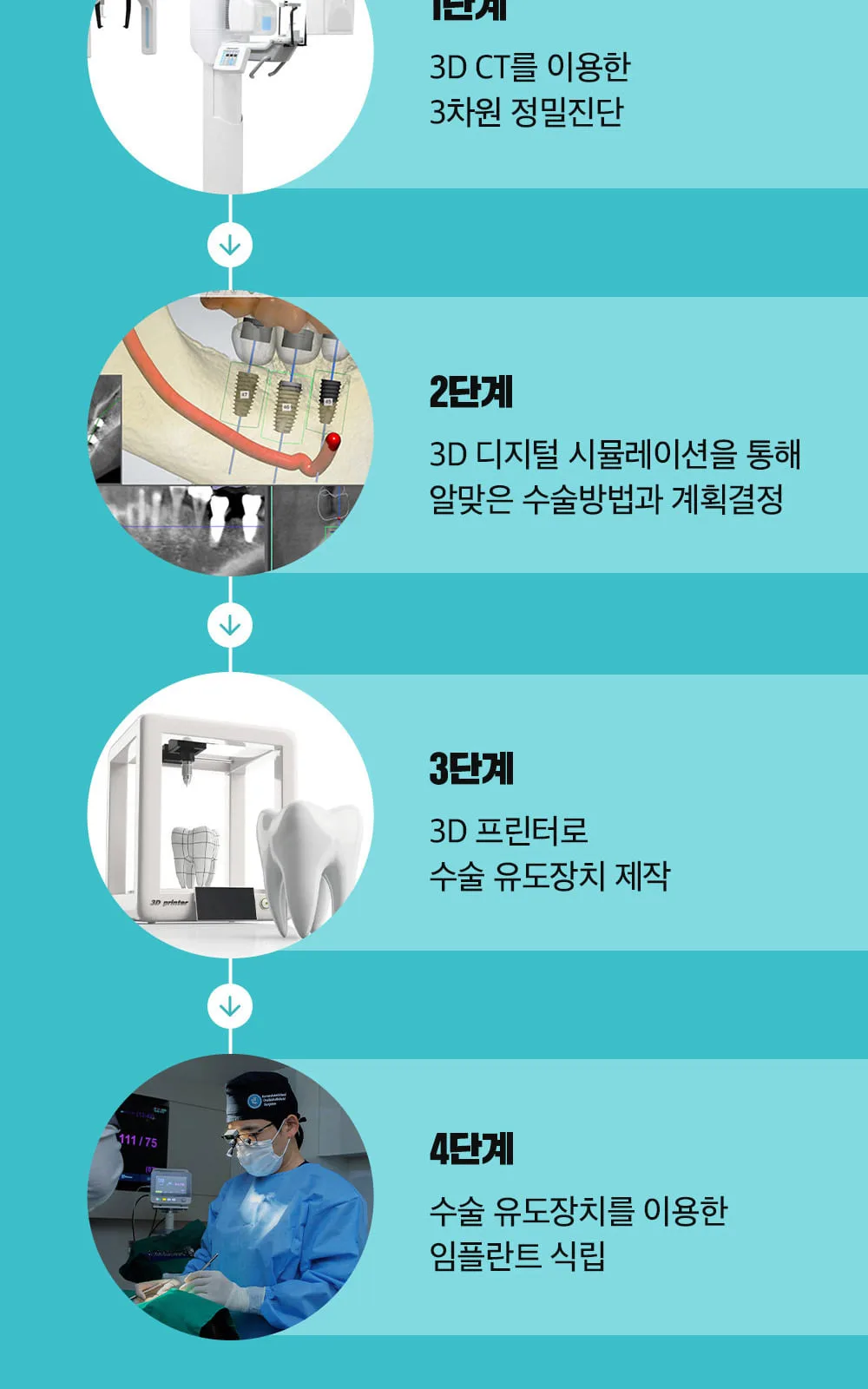 시술 상세 11