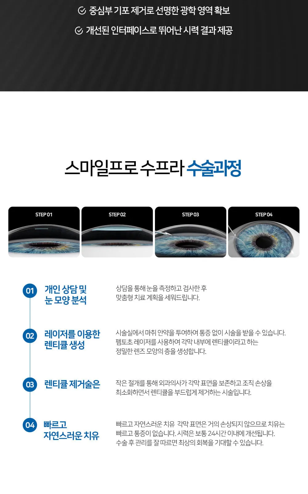 시술 상세 6