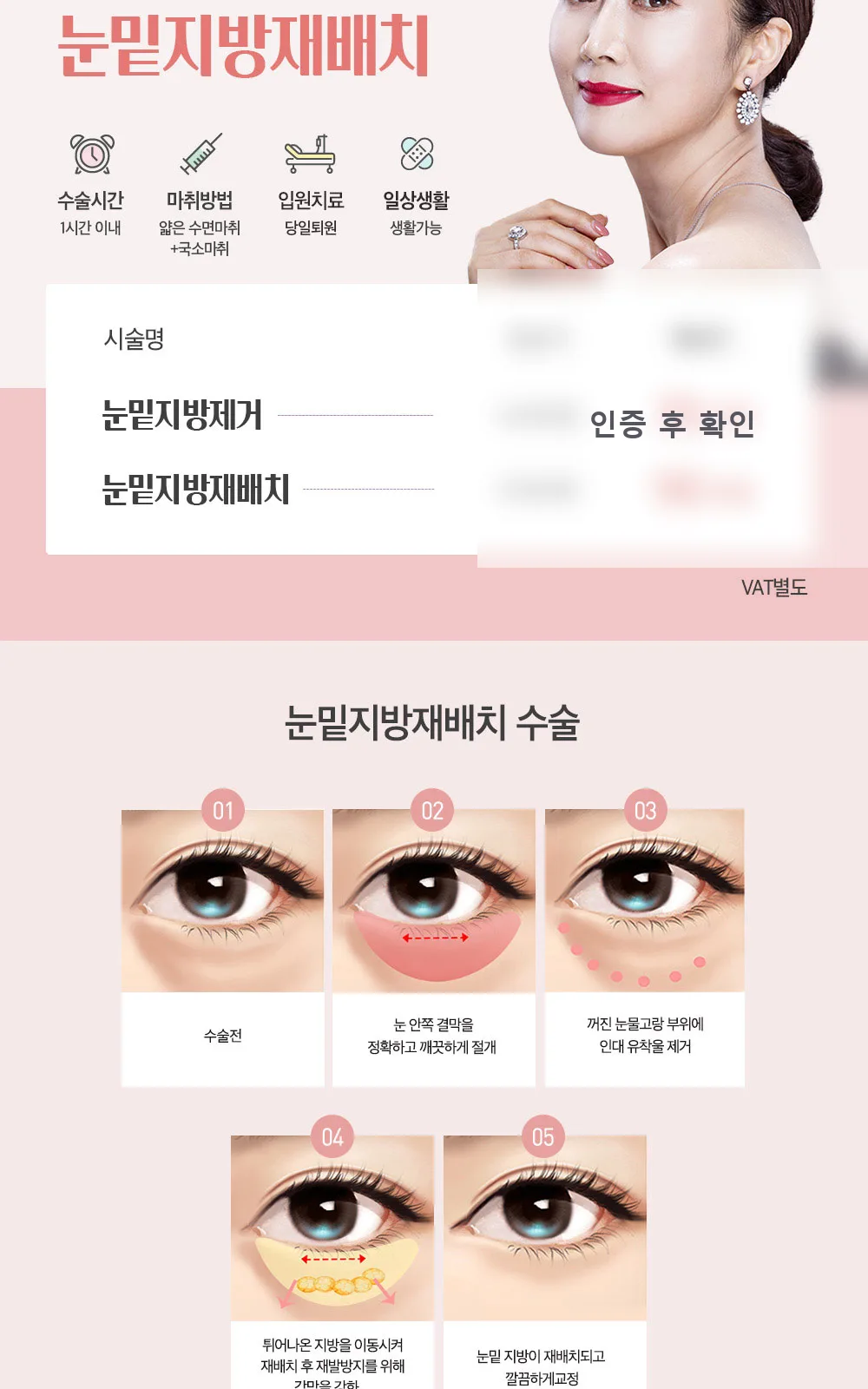 시술 상세 6