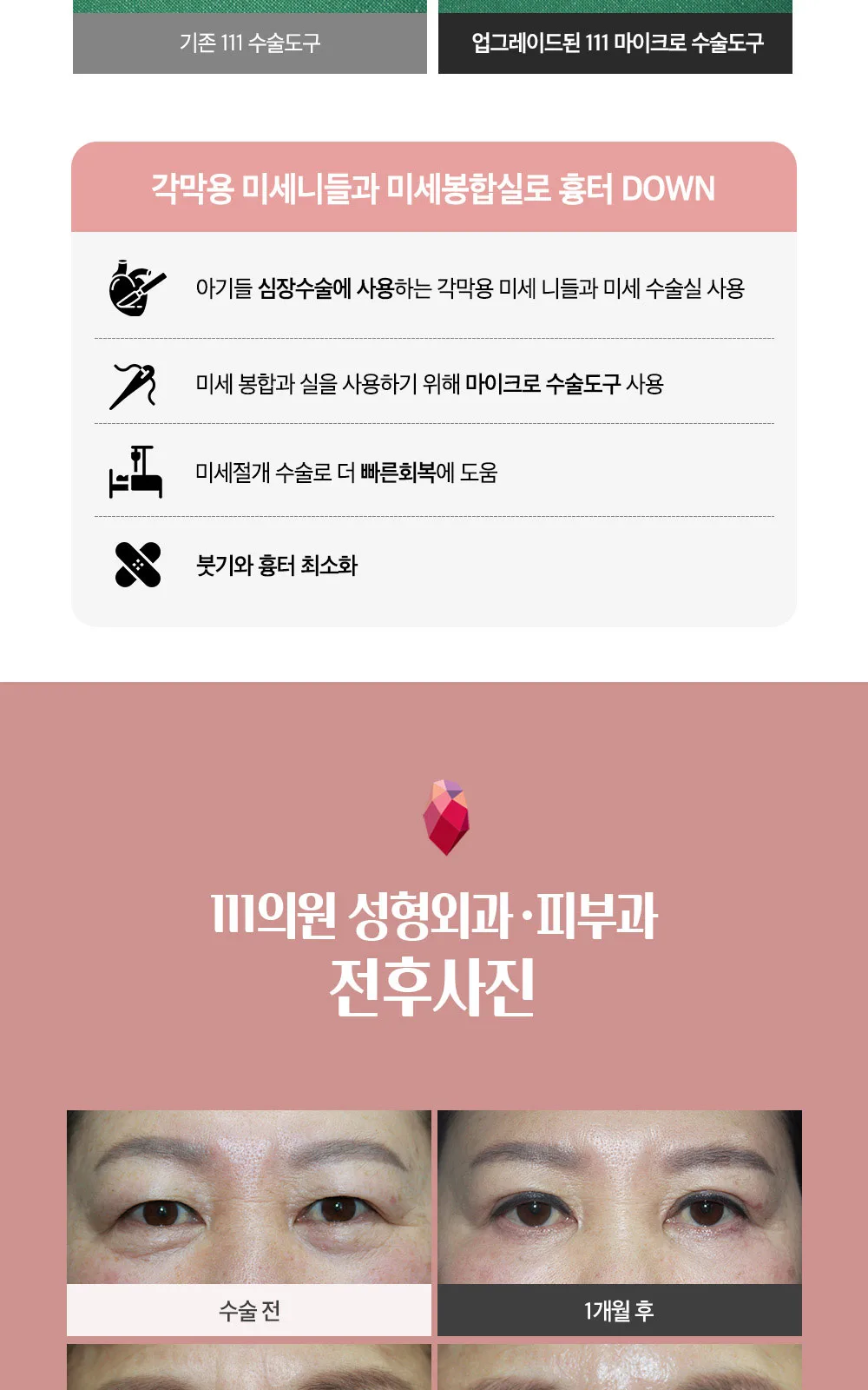 시술 상세 8