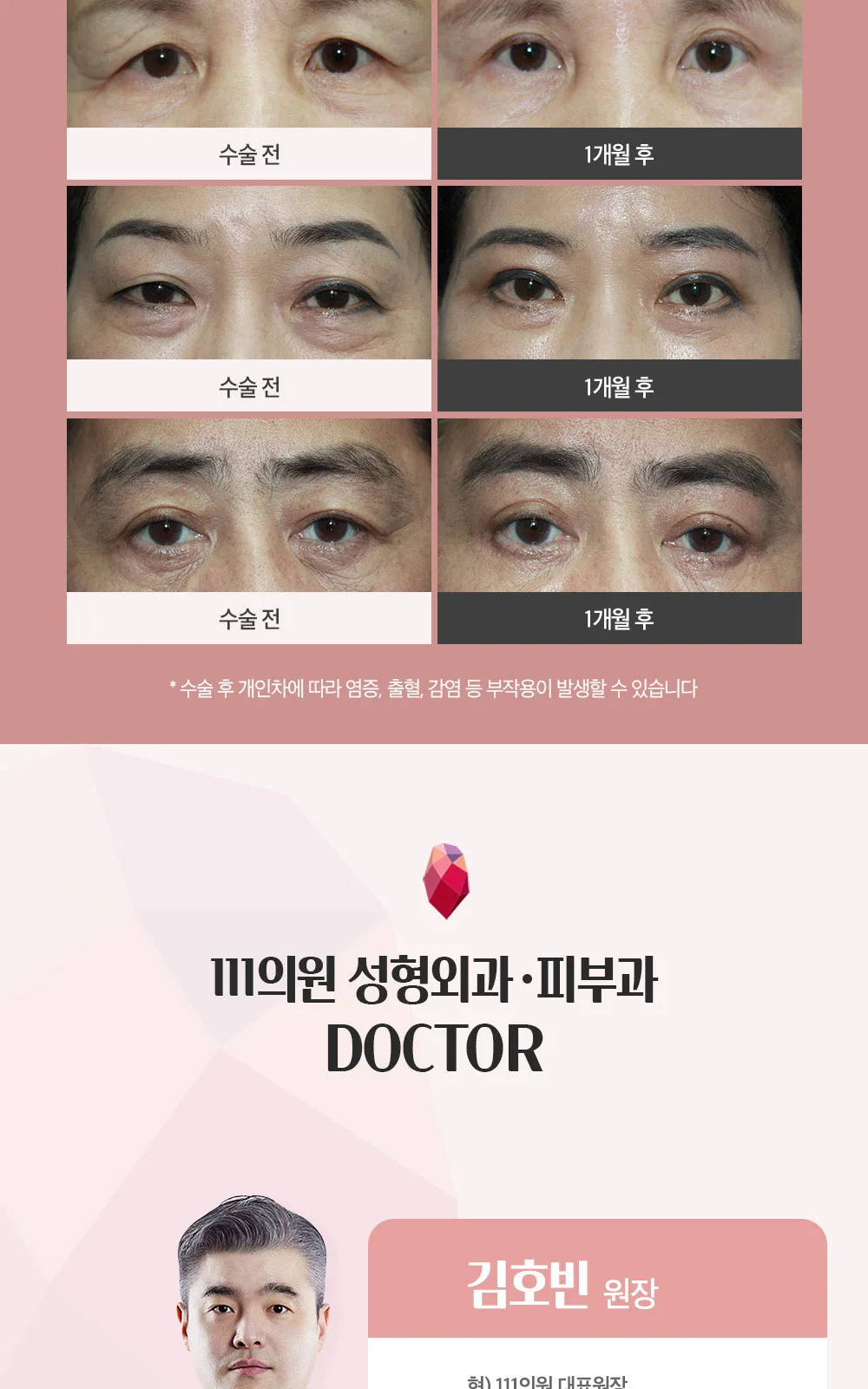 시술 상세 9