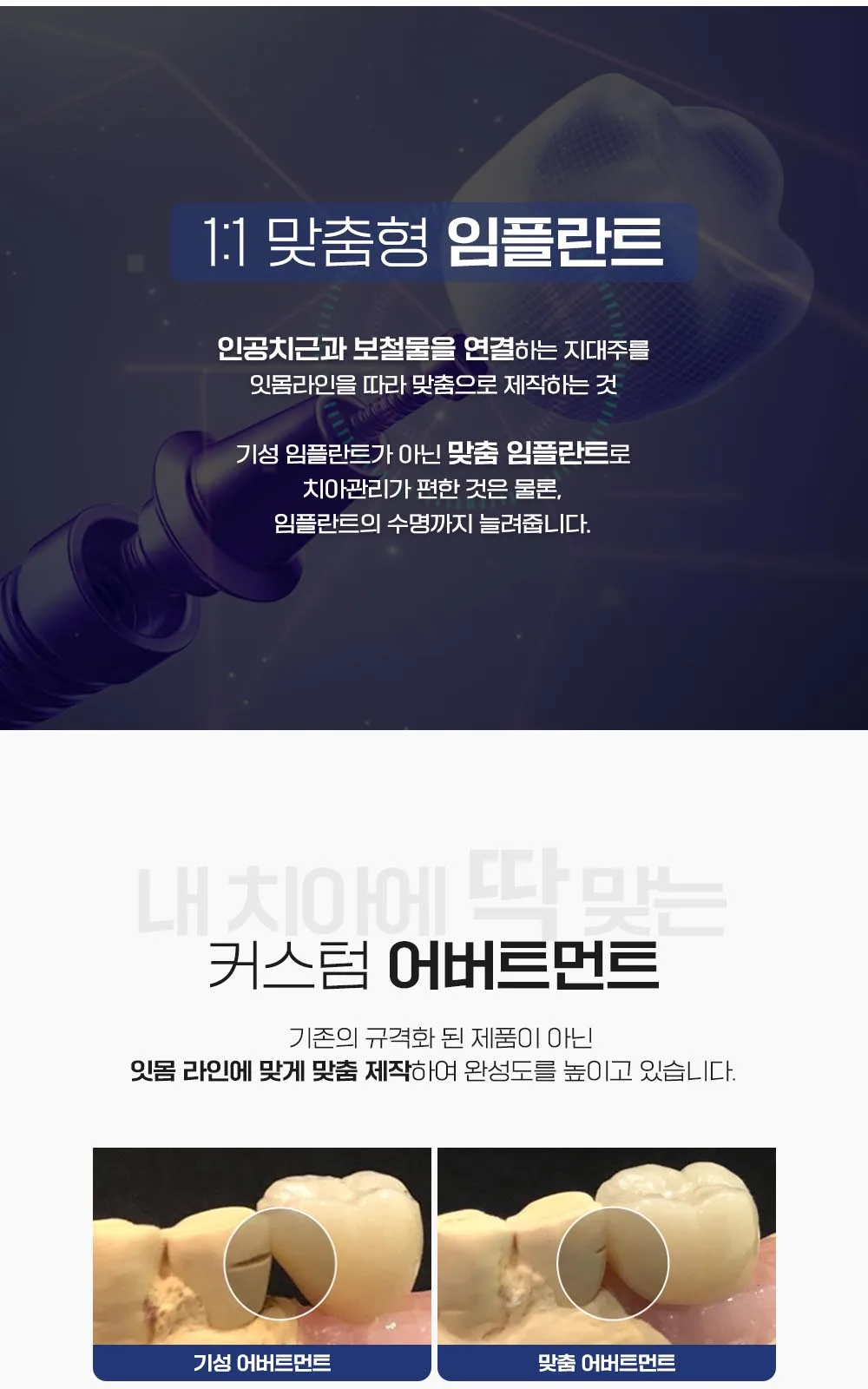 시술 상세 7