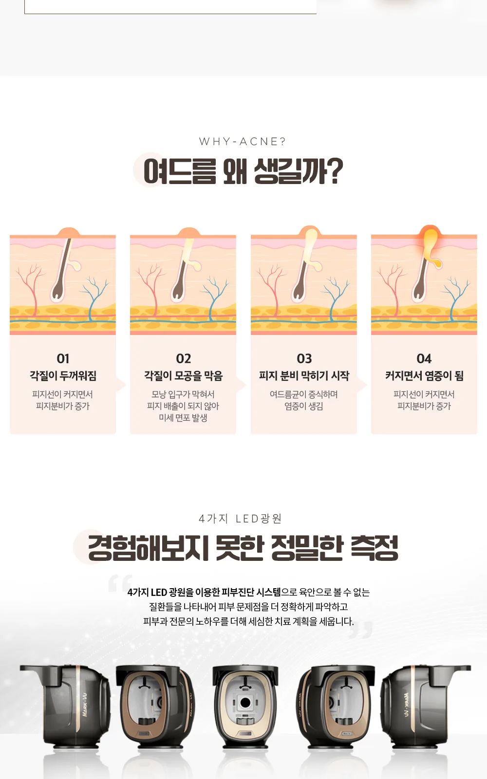 시술 상세 6