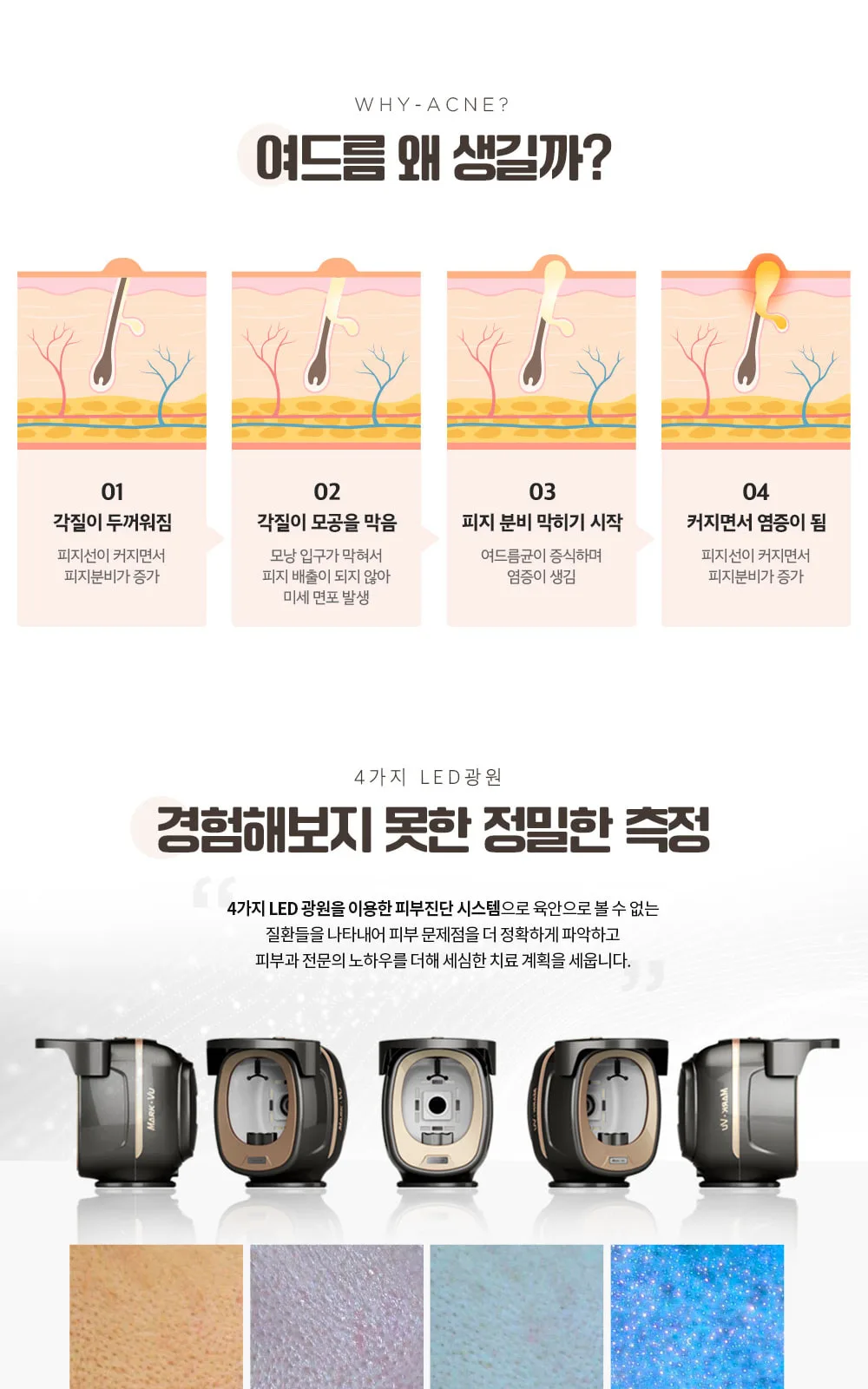 시술 상세 5