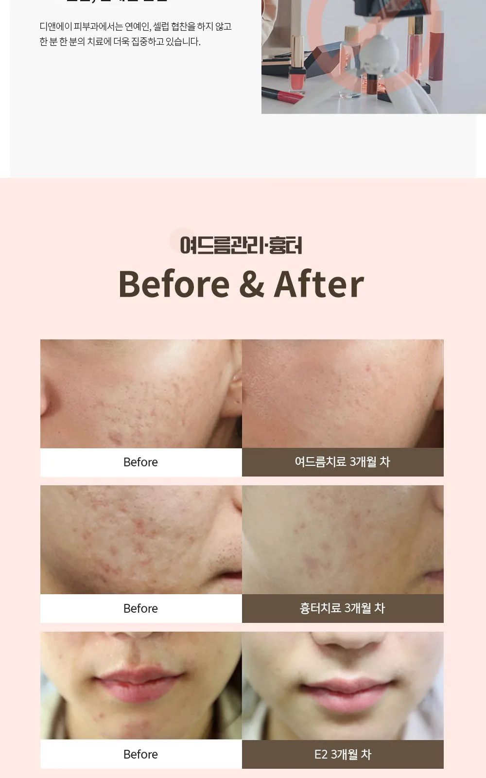 시술 상세 8