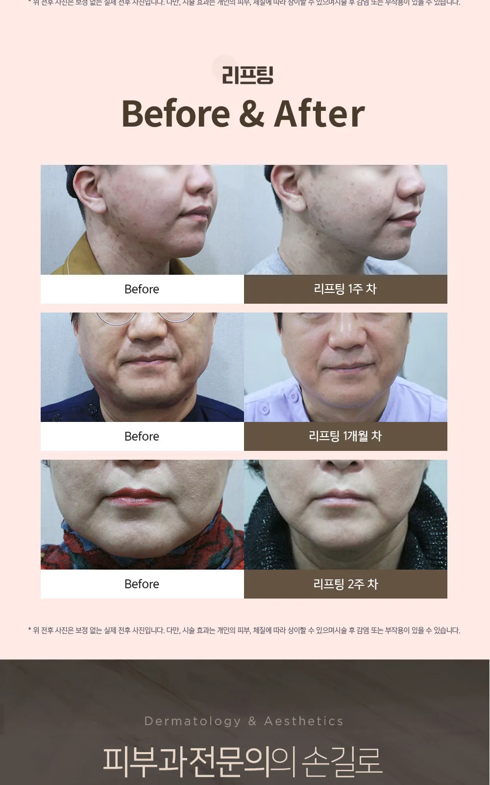시술 상세 10