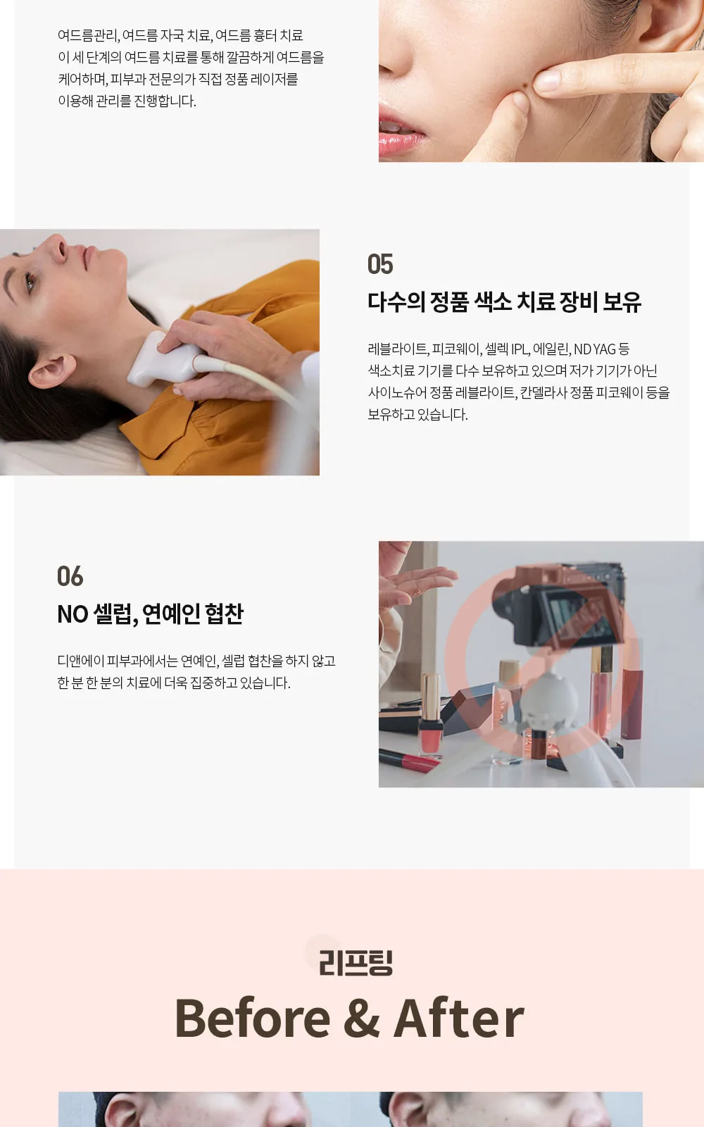 시술 상세 5