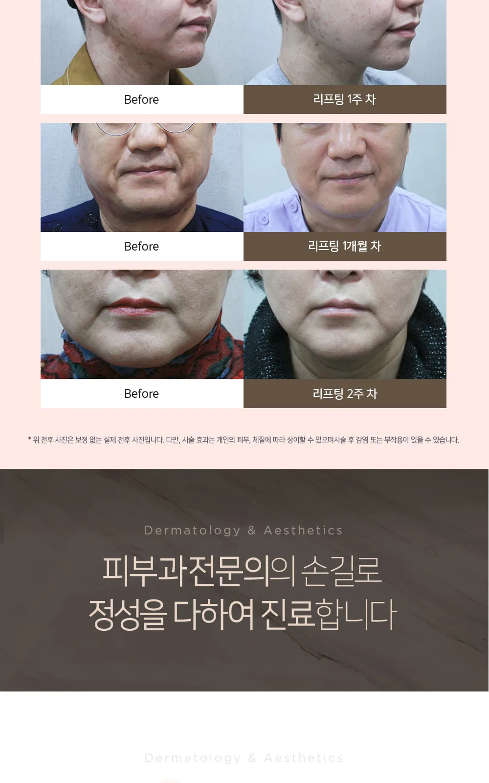 시술 상세 6