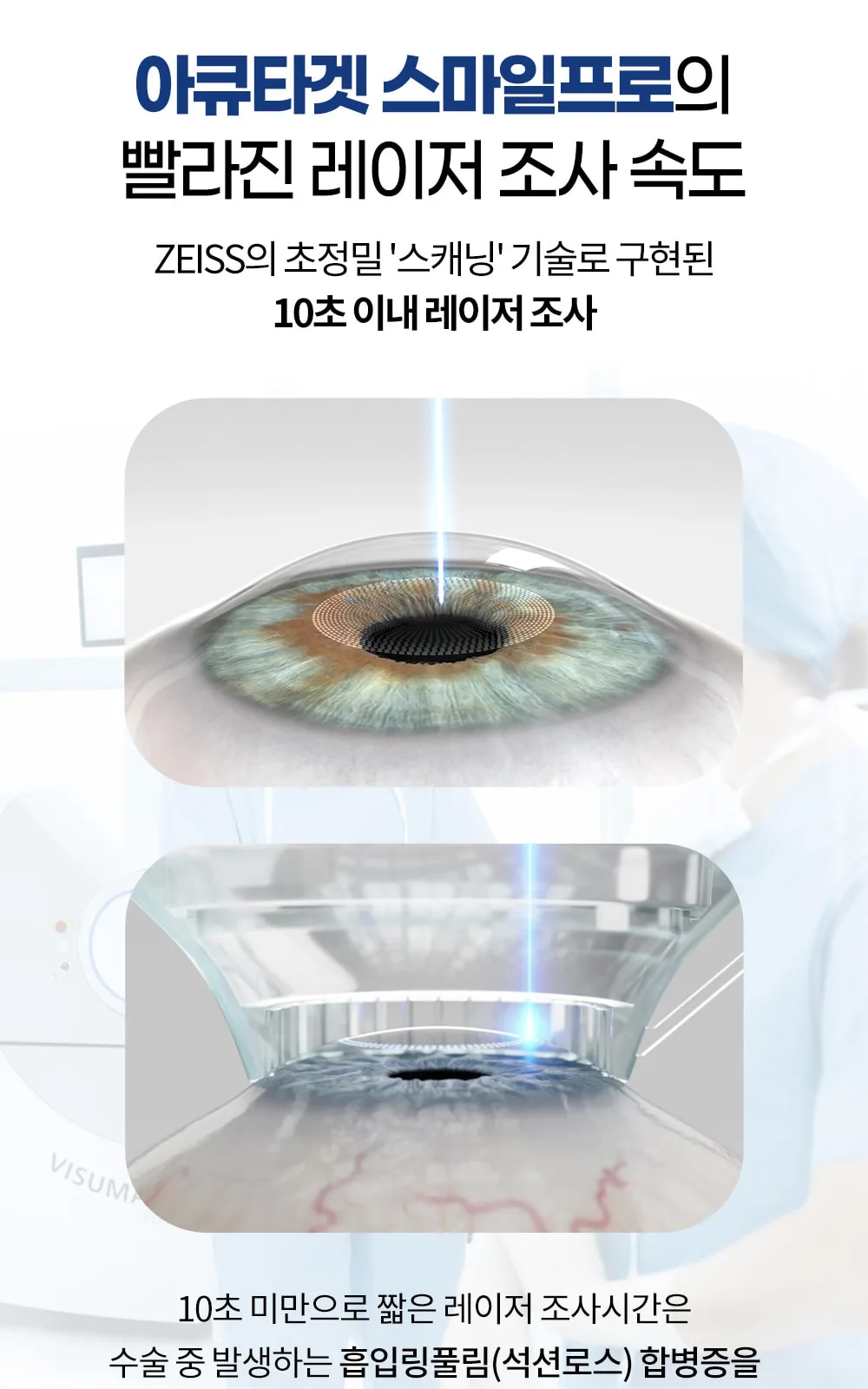 시술 상세 6