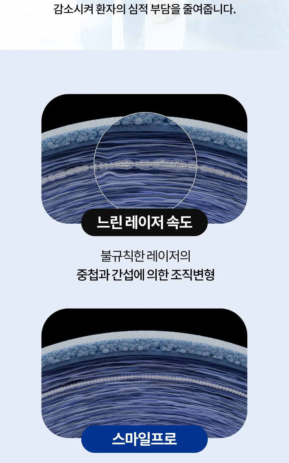 시술 상세 7