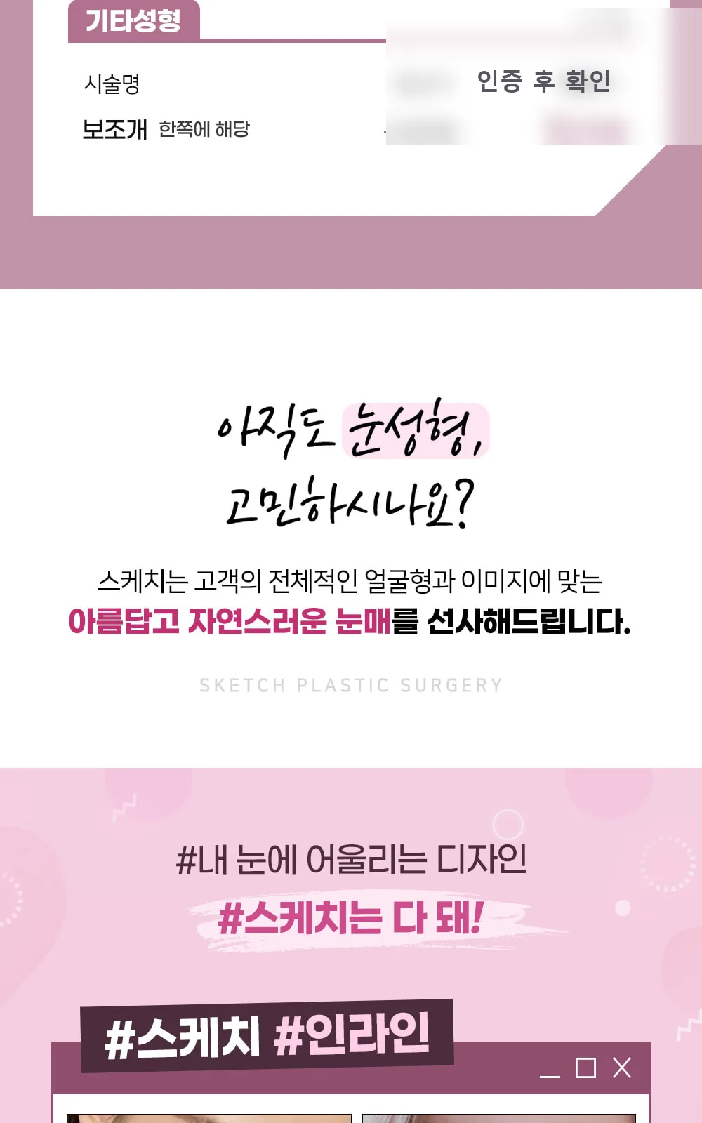 시술 상세 3