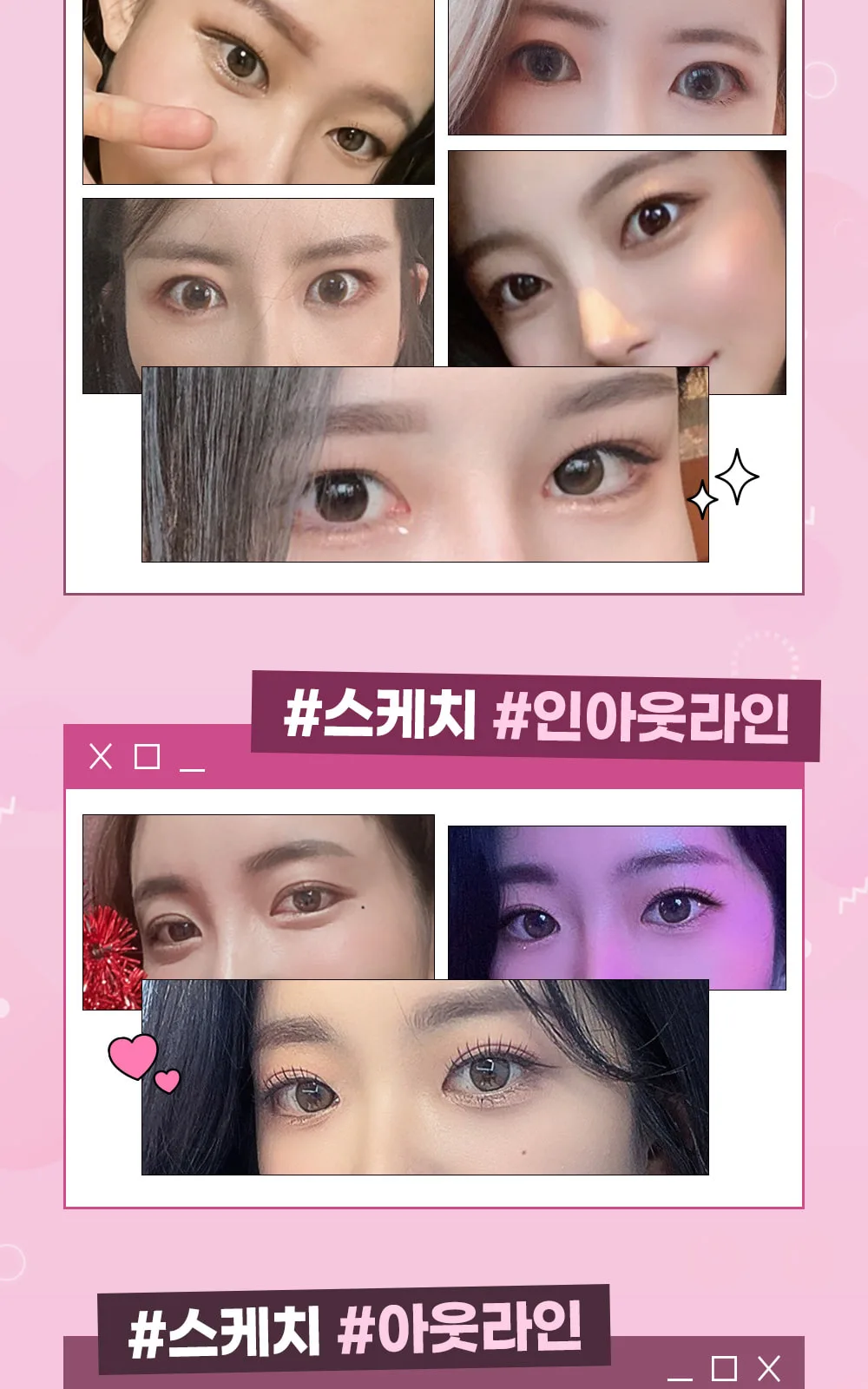 시술 상세 4