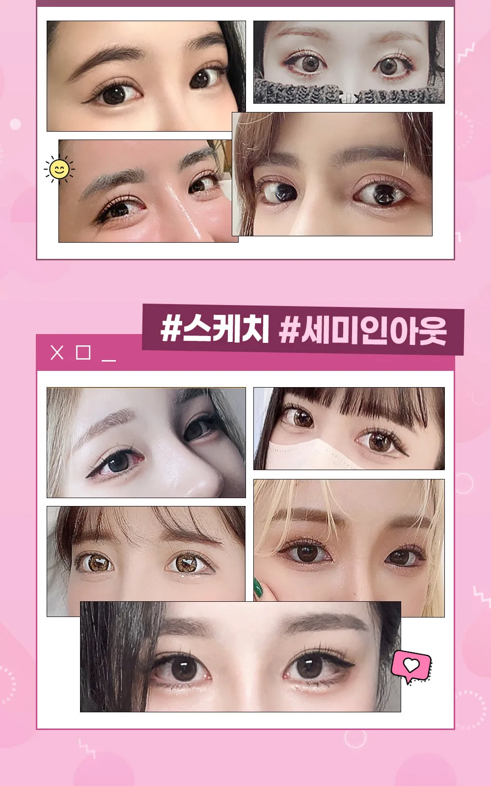 시술 상세 5