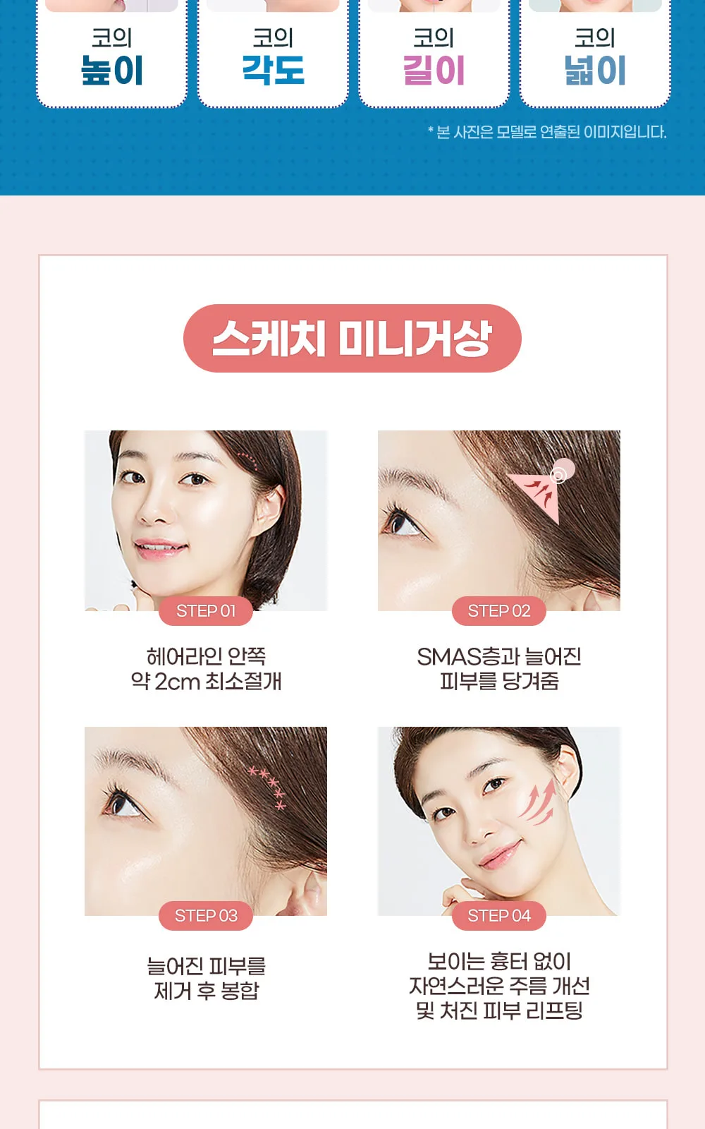 시술 상세 7