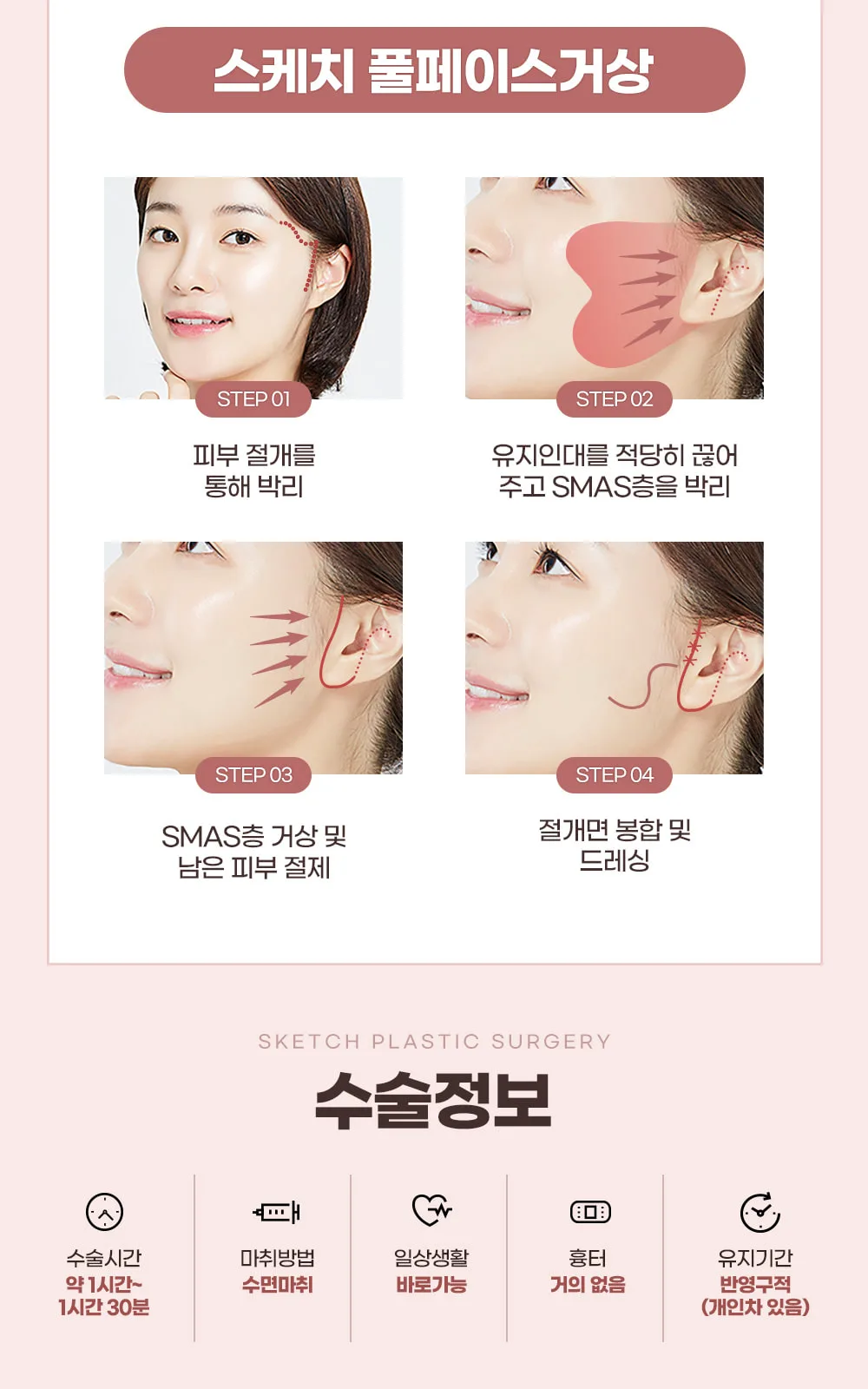 시술 상세 8