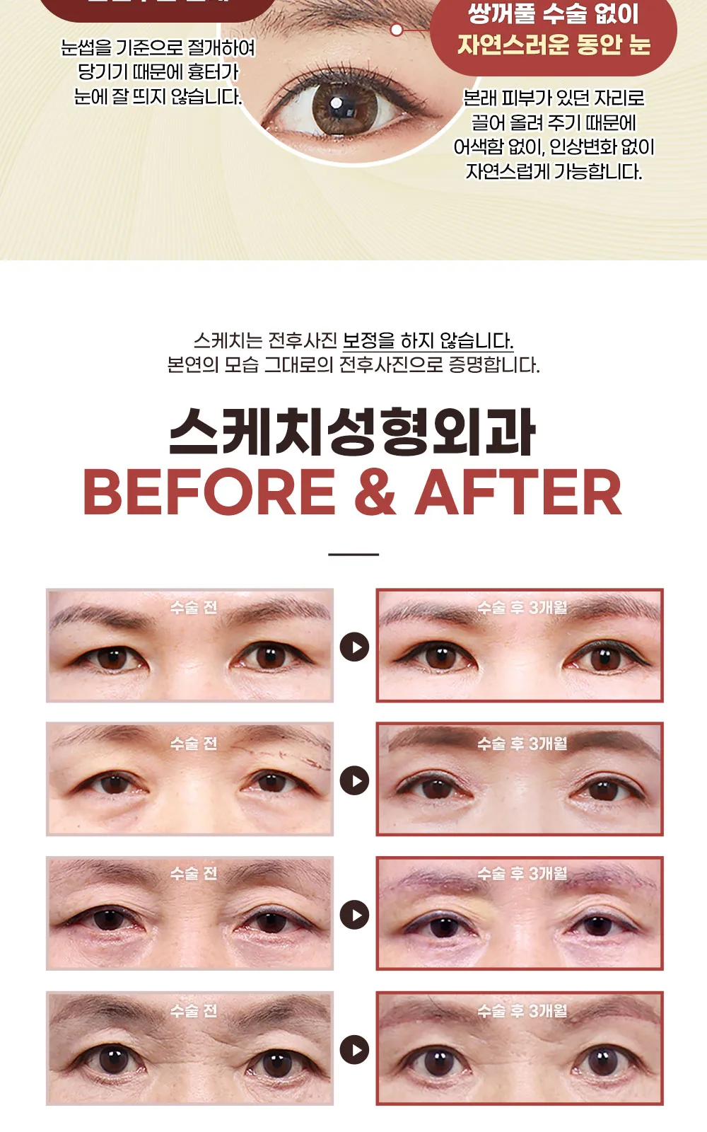 시술 상세 2