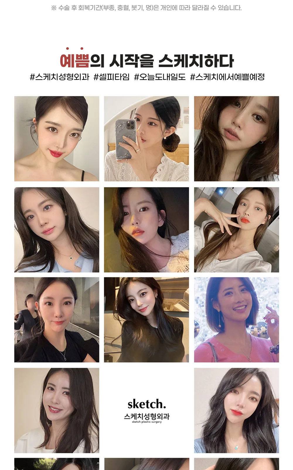 시술 상세 3