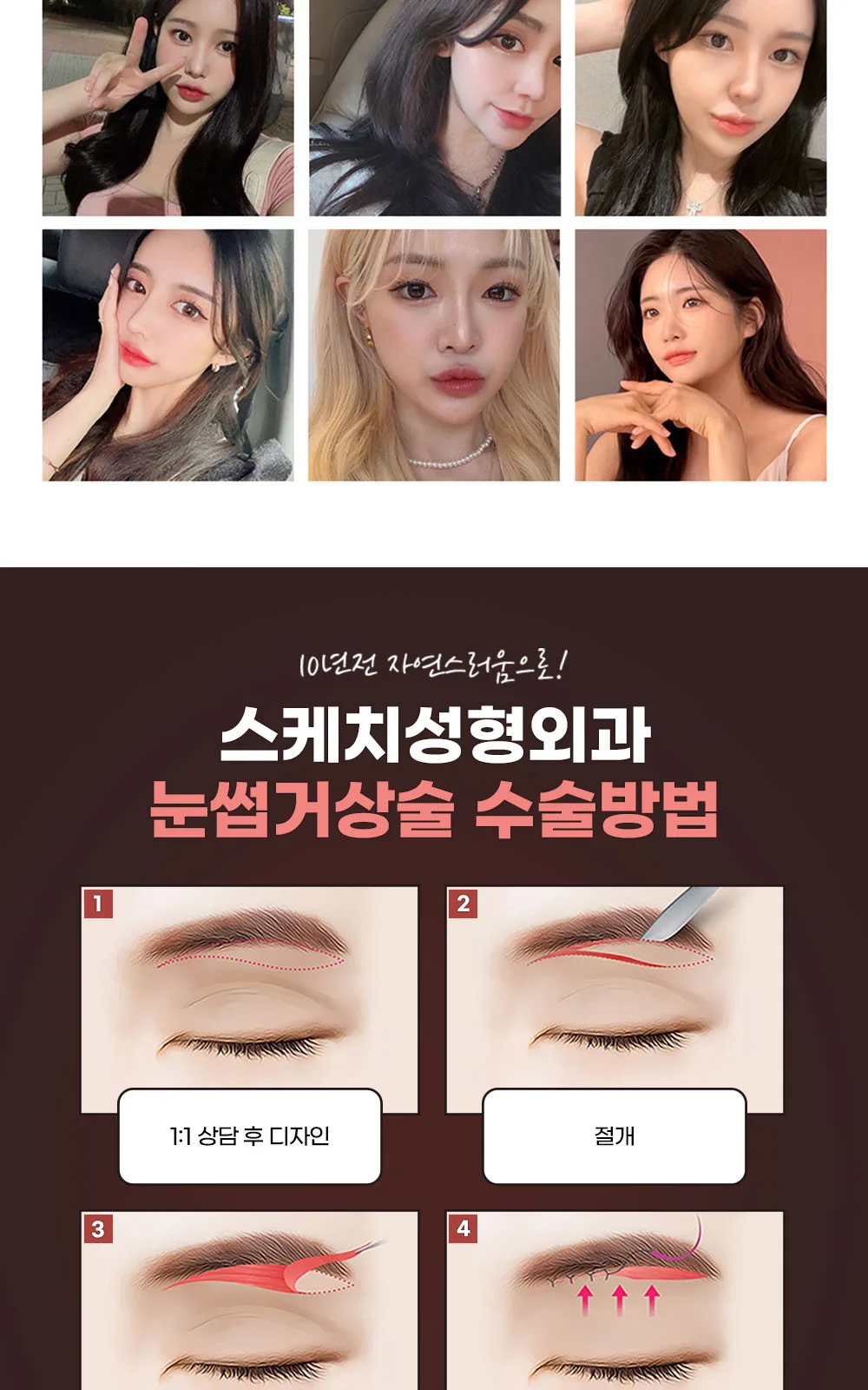 시술 상세 4