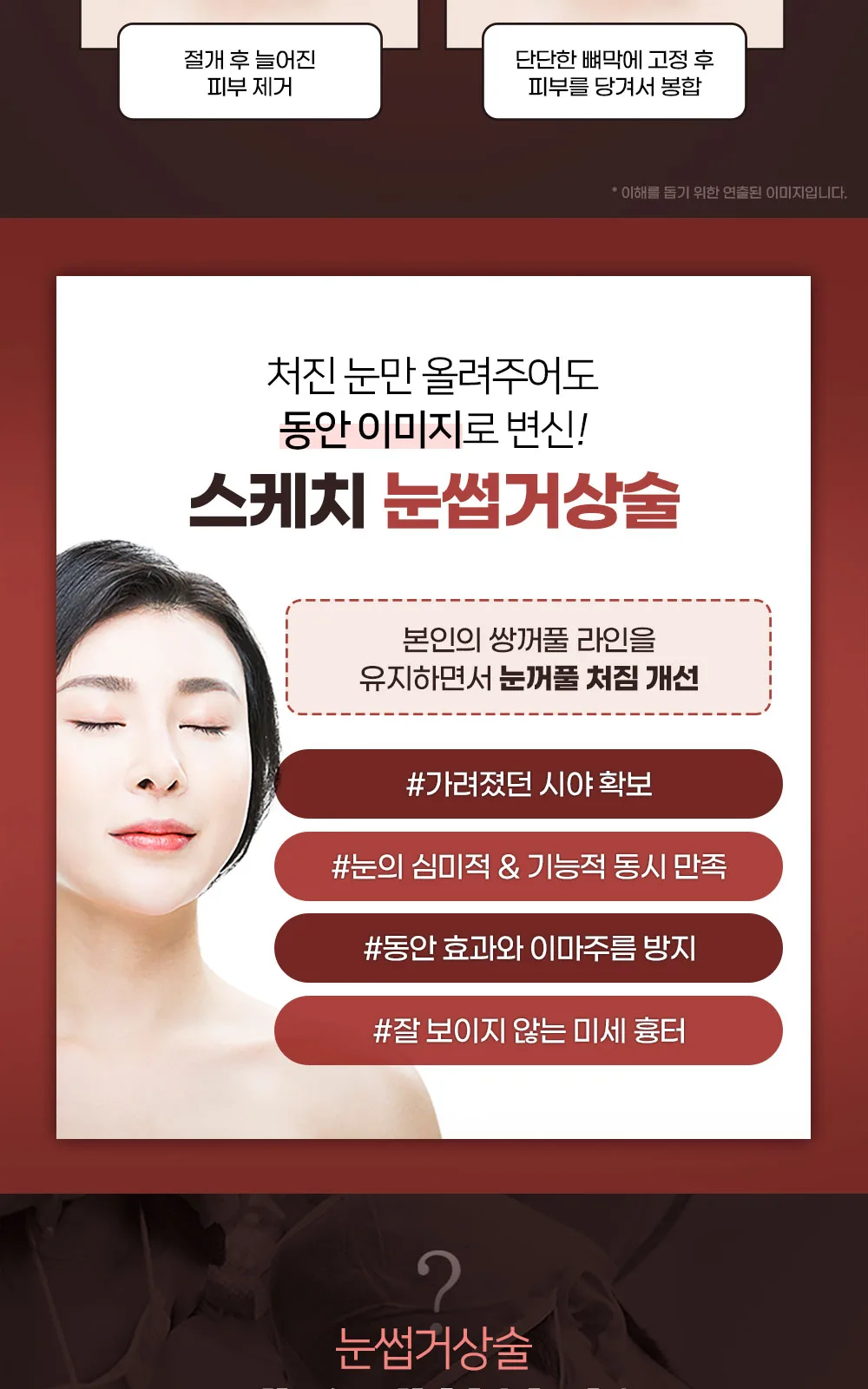 시술 상세 5
