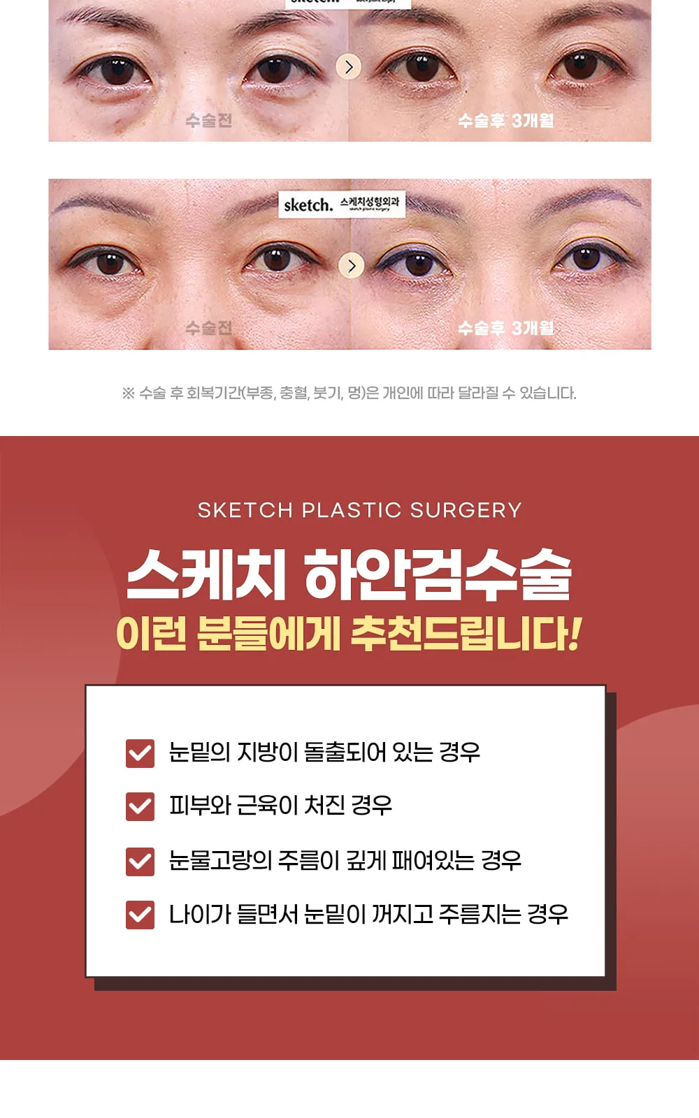 시술 상세 3